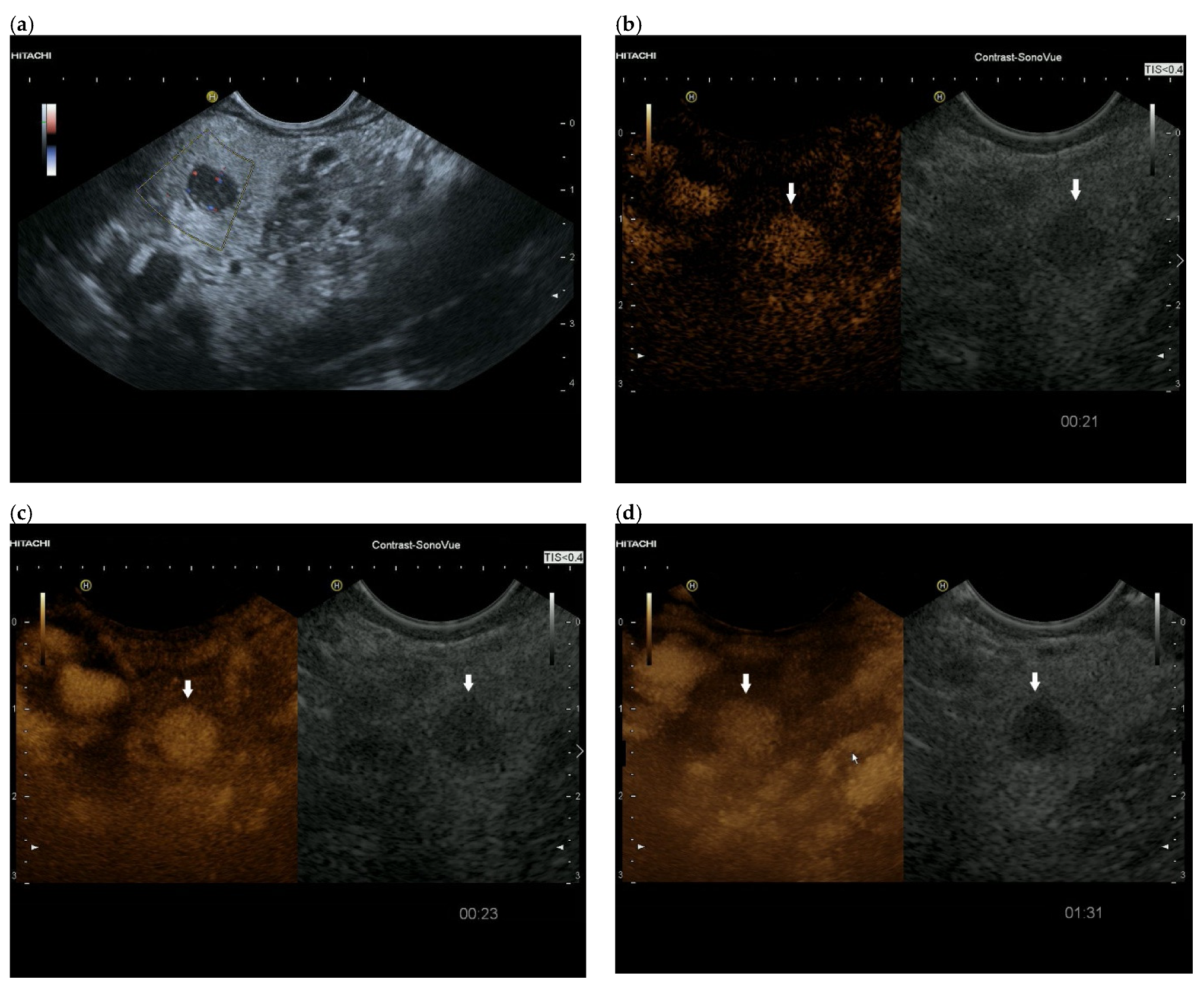 Cancers 15 02546 g004