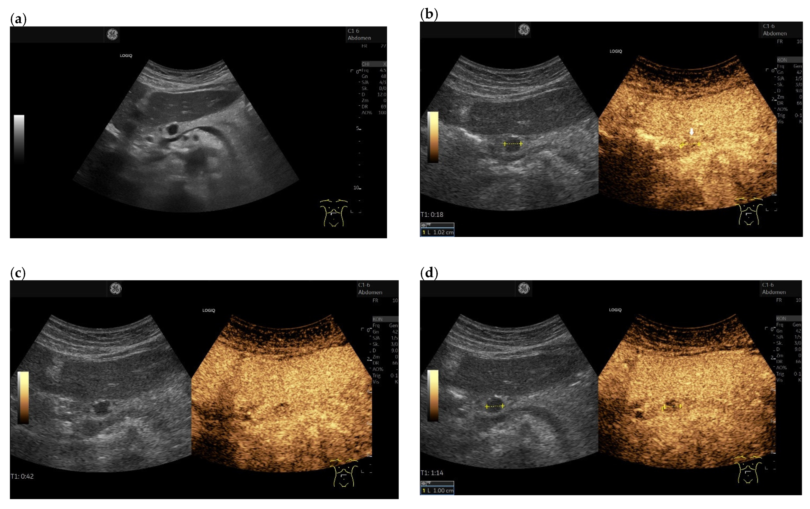 Cancers 15 02546 g007a