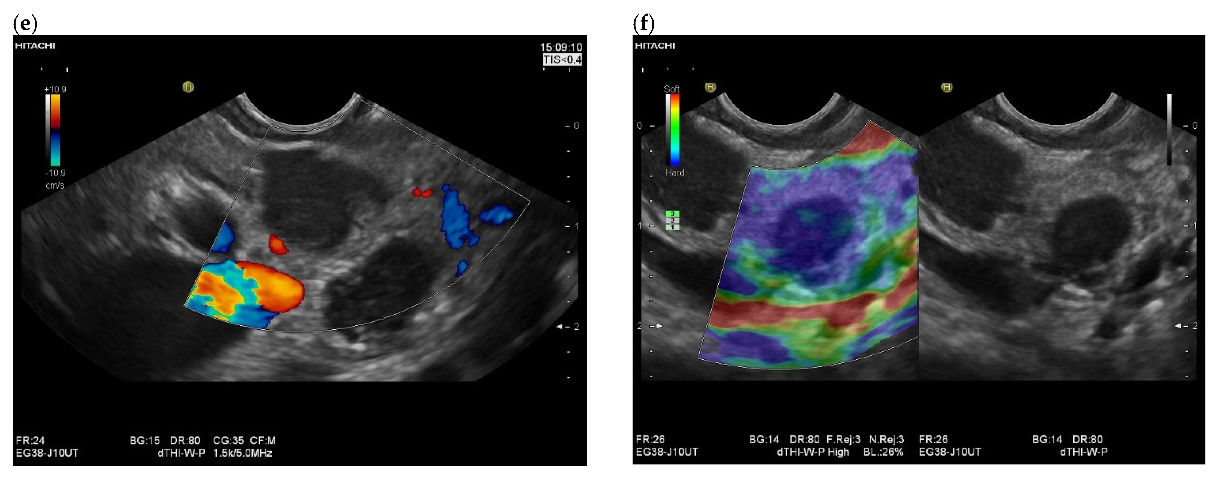 Cancers 15 02546 g007b