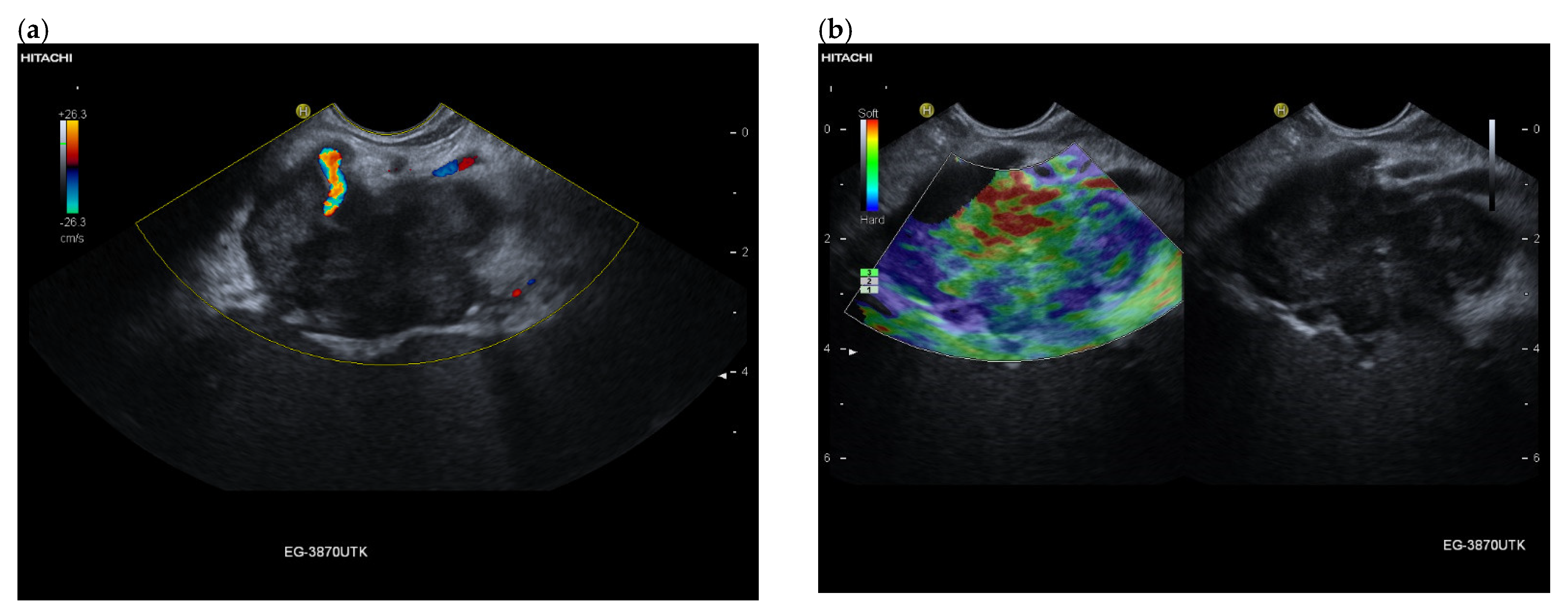 Cancers 15 02546 g010a