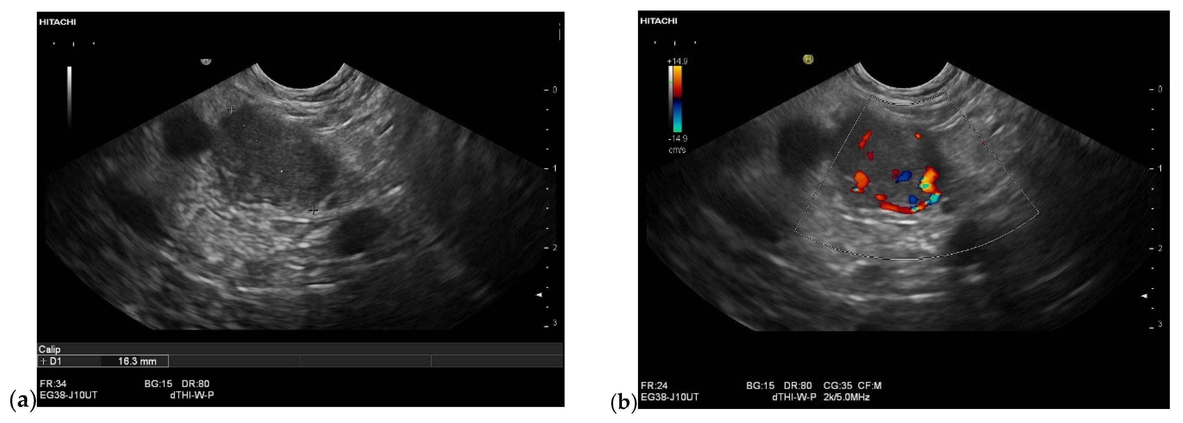 Cancers 15 02546 g011a