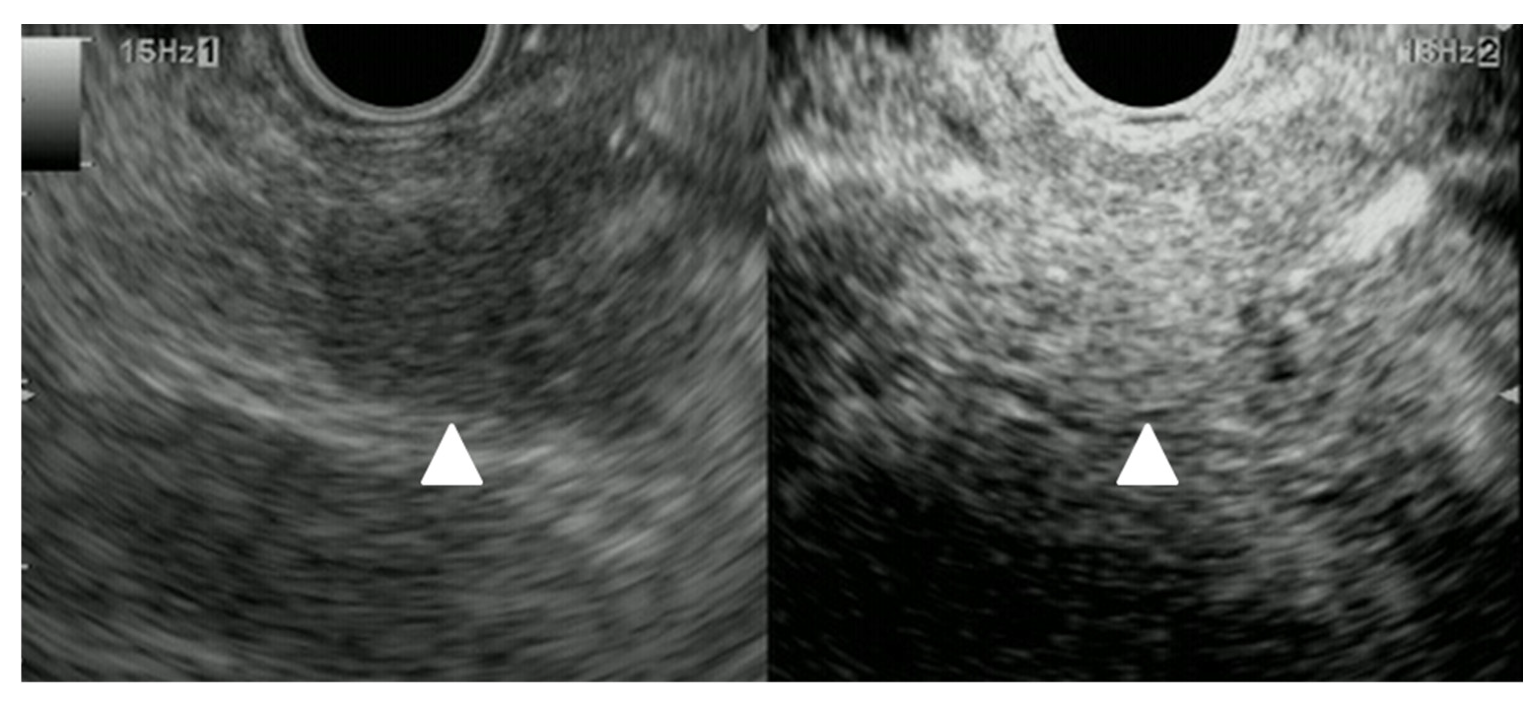 Cancers 15 02546 g014