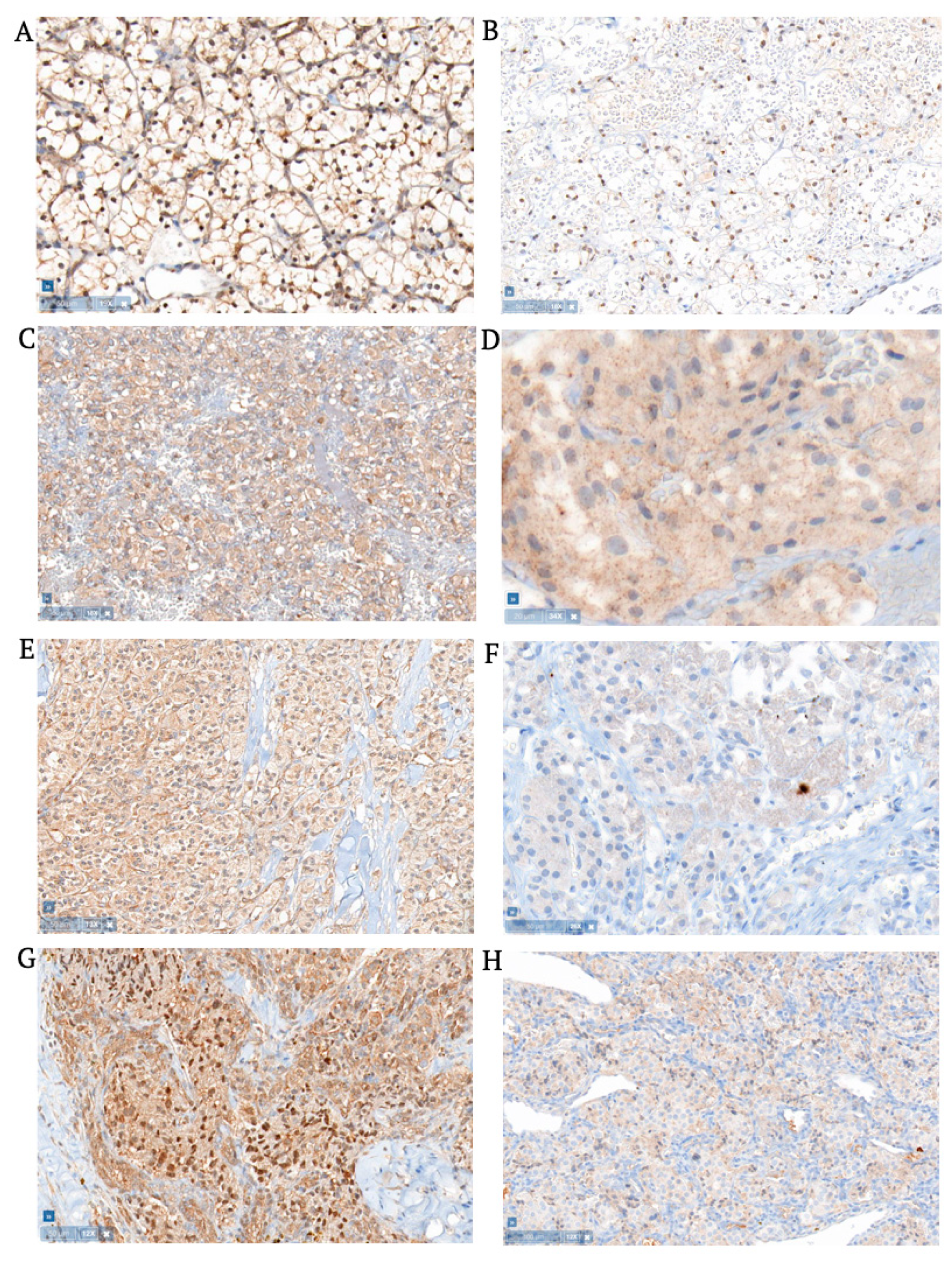 Cancers 15 02551 g002 Cancers 15 02551 g002