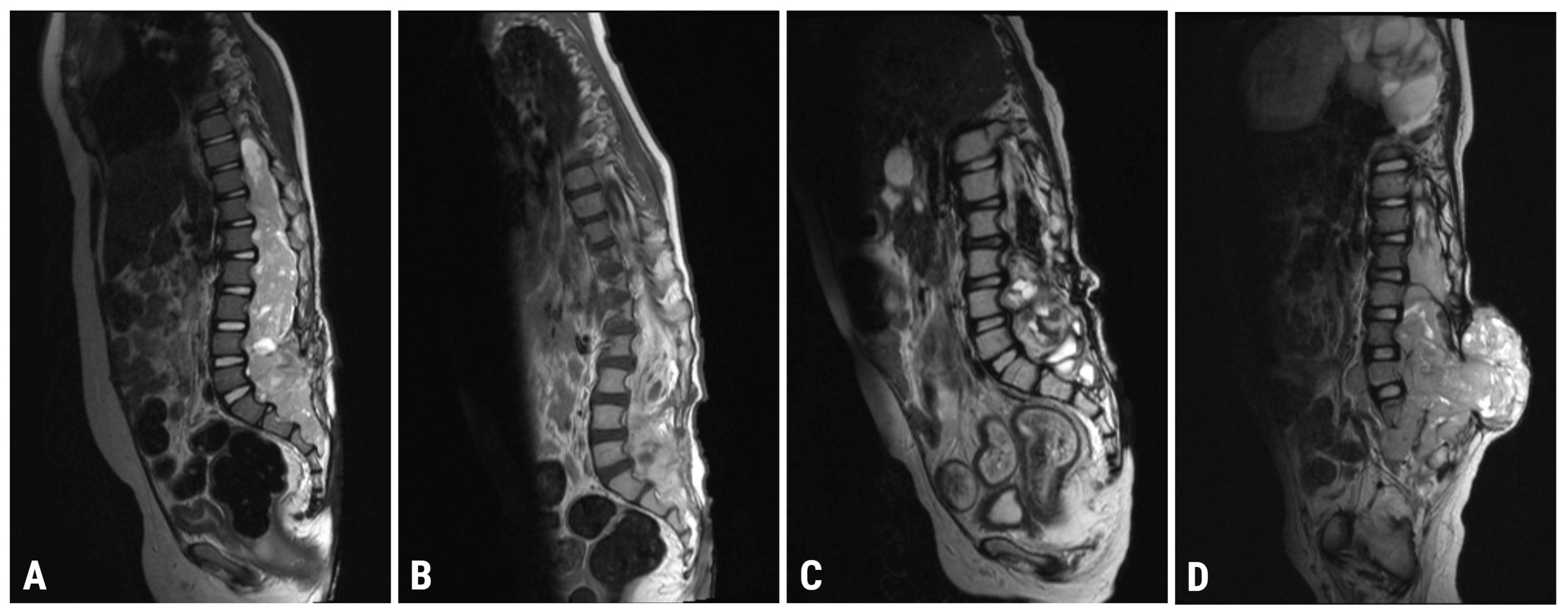 Cancers 15 02563 g001