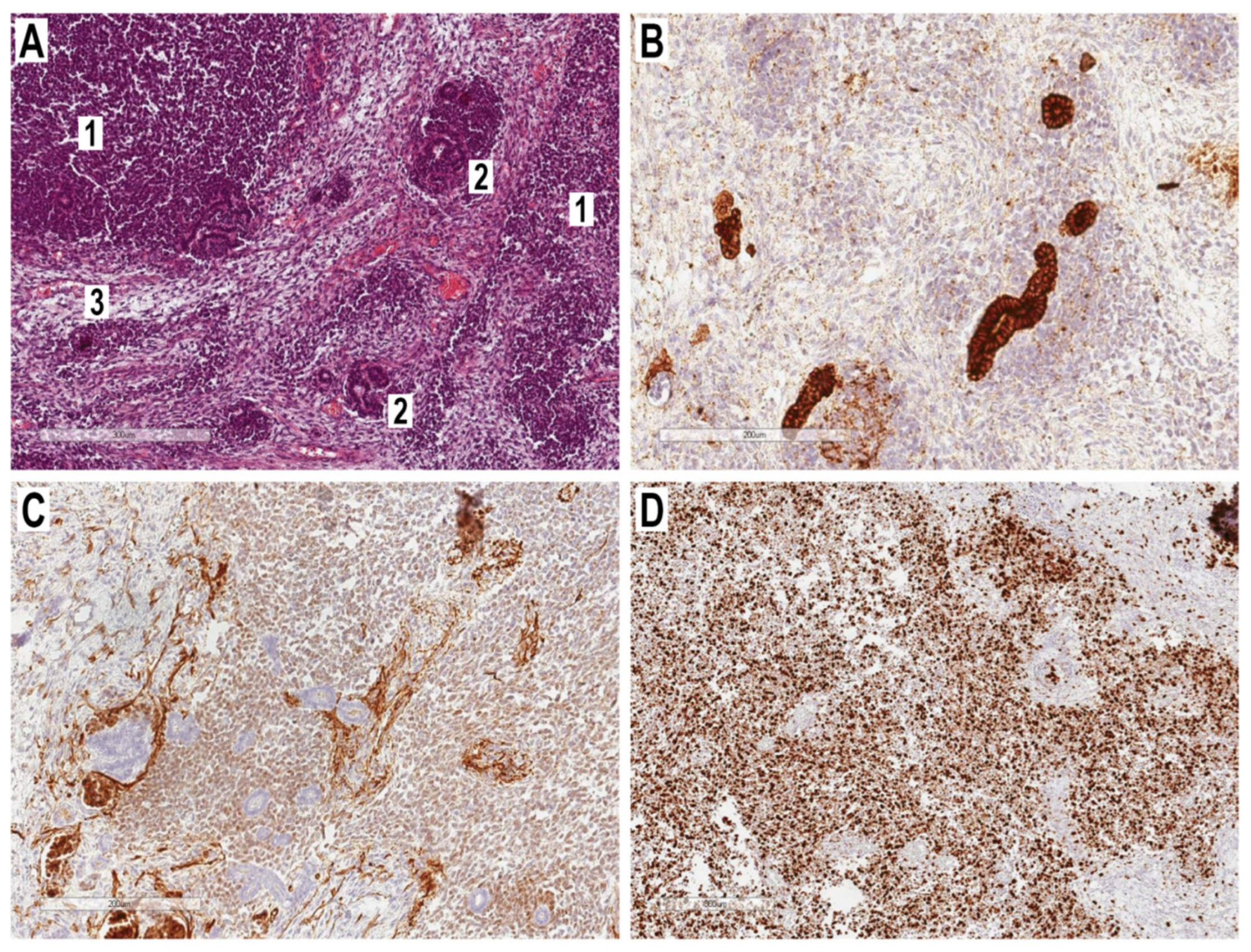 Cancers 15 02563 g003