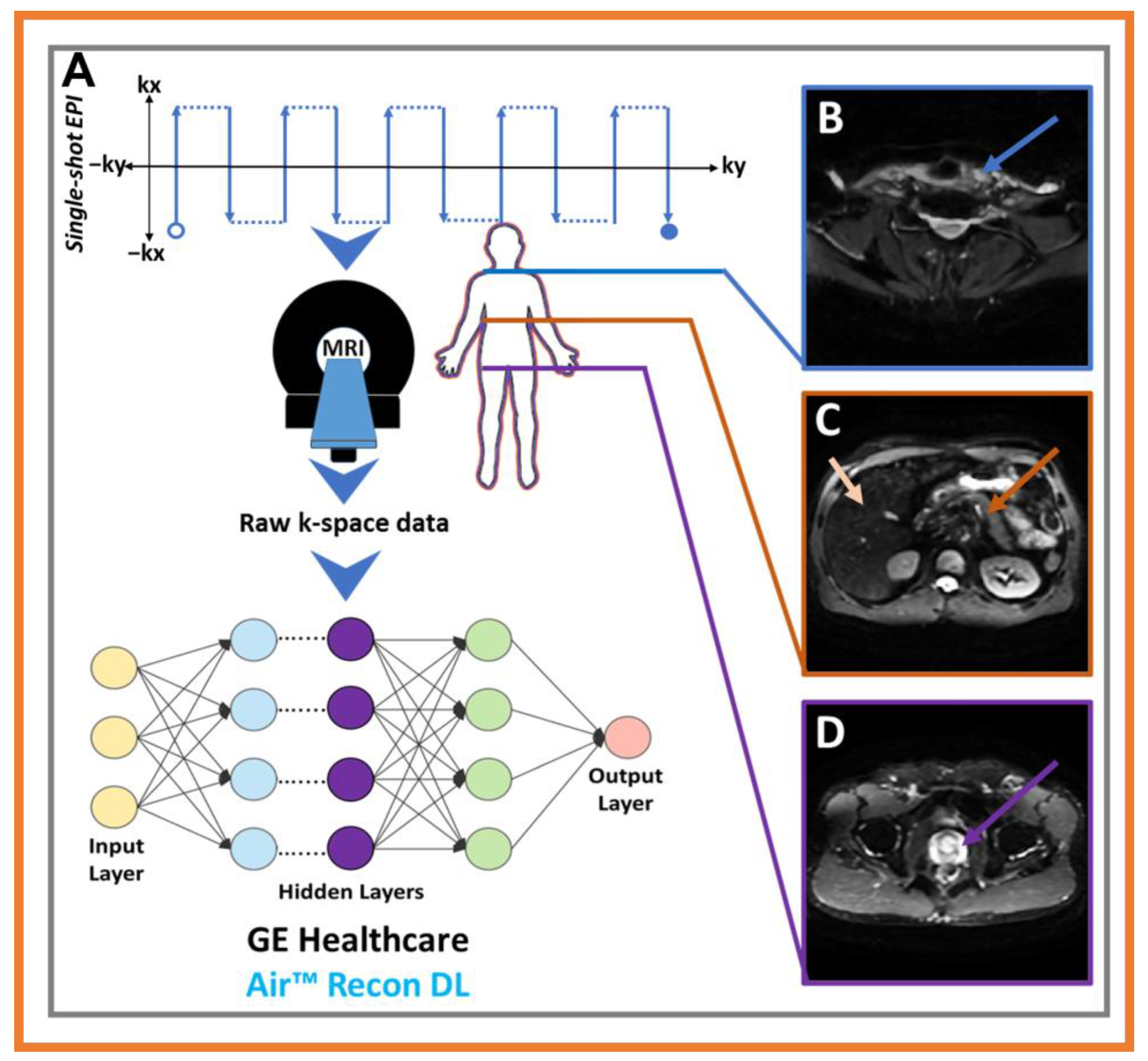 Cancers 15 02573 g004 Cancers 15 02573 g004