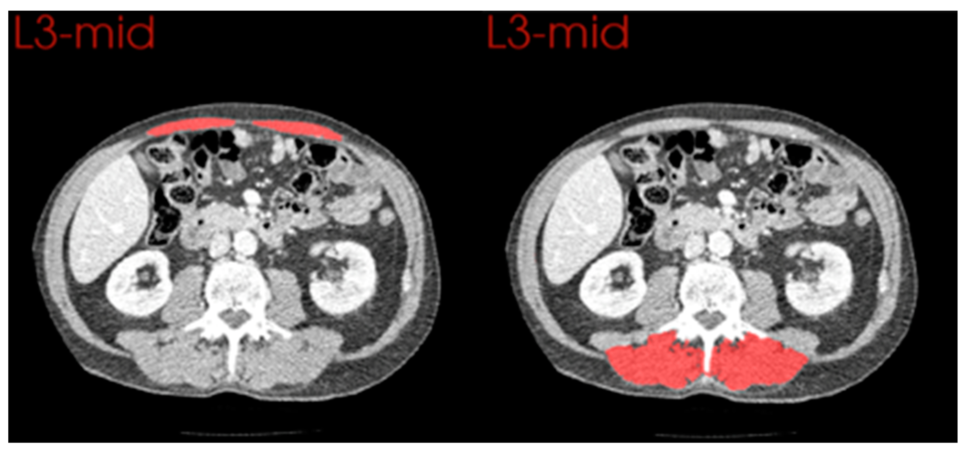 Cancers 15 02577 g005