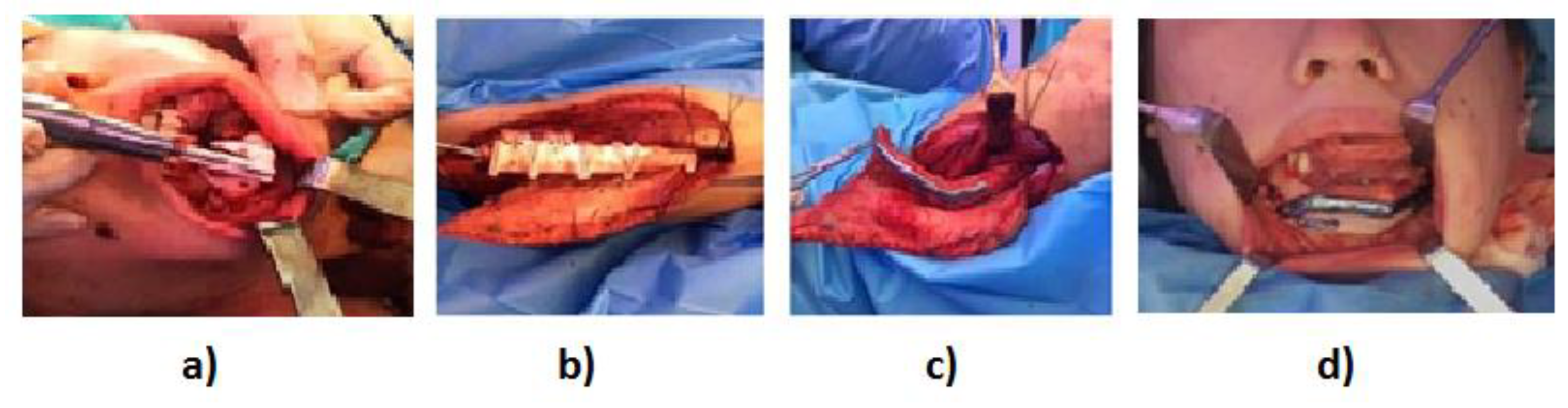 Cancers 15 02582 g002