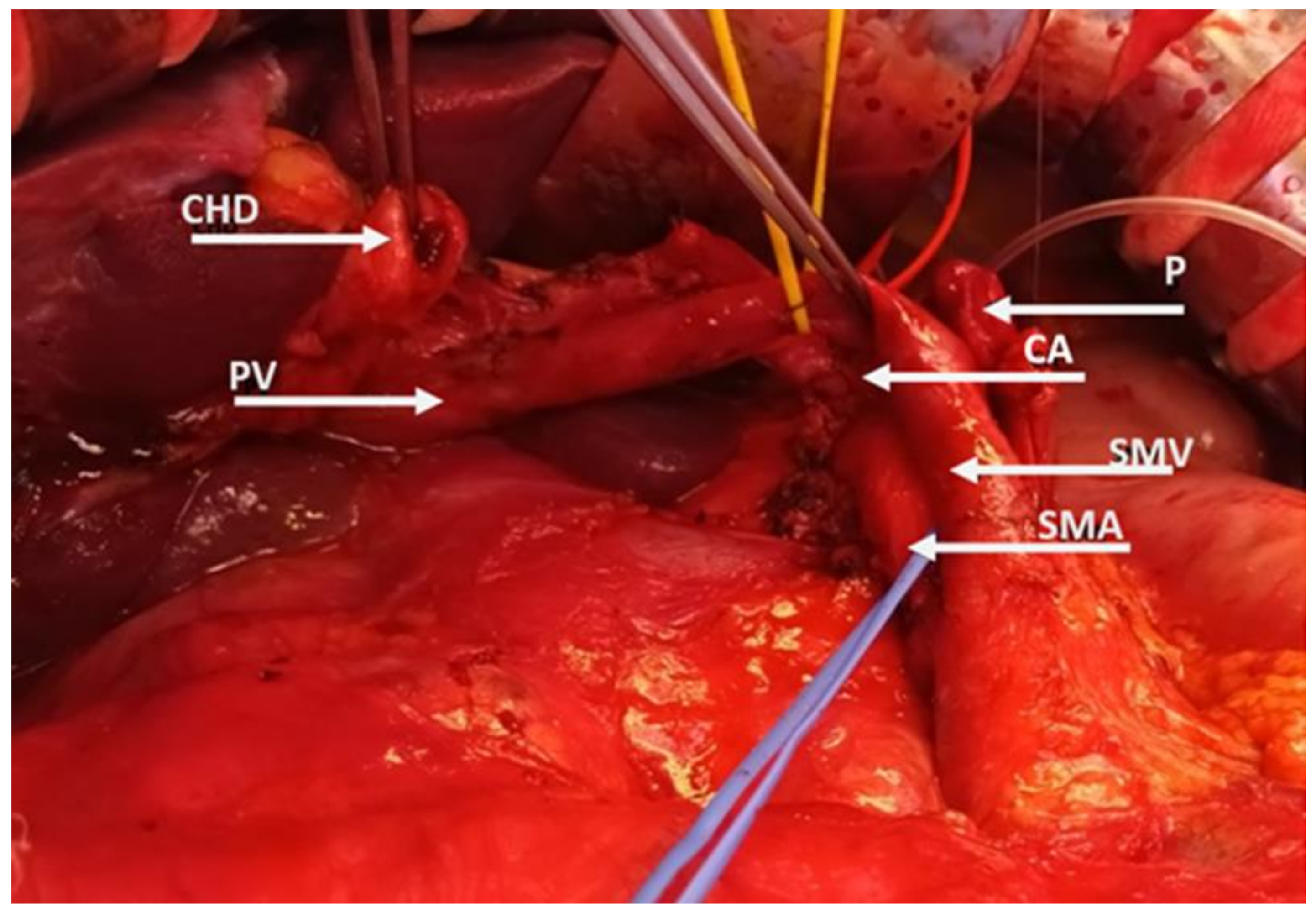Cancers 15 02584 g002a