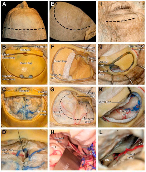 Frontiers | Comprehensive microsurgical anatomy of the