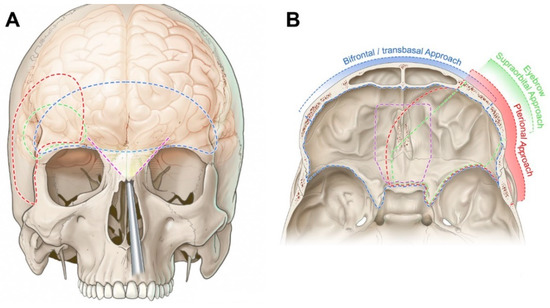 Surgical Anatomy and Approaches of the Anterior Cranial