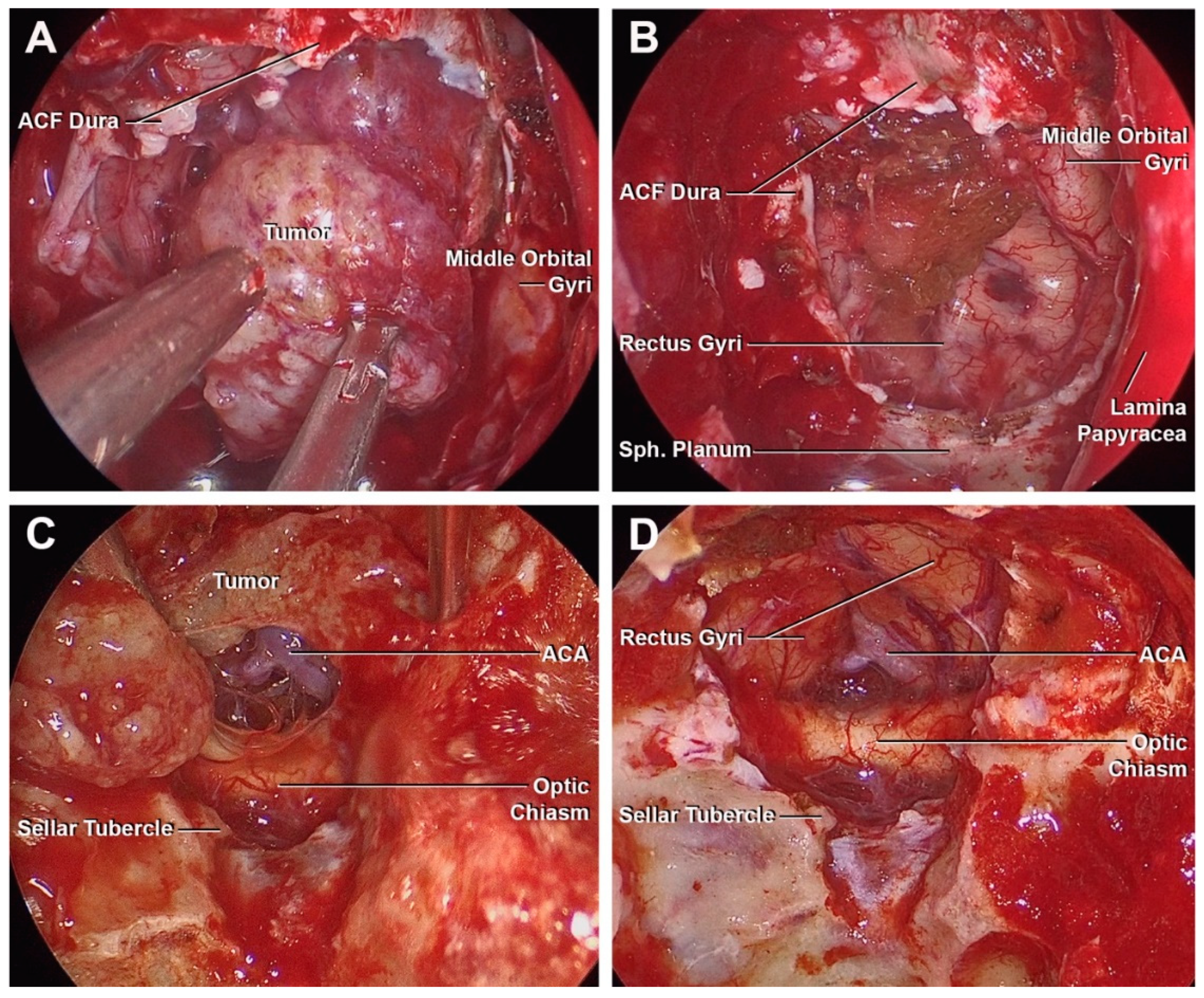 Cancers 15 02587 g006