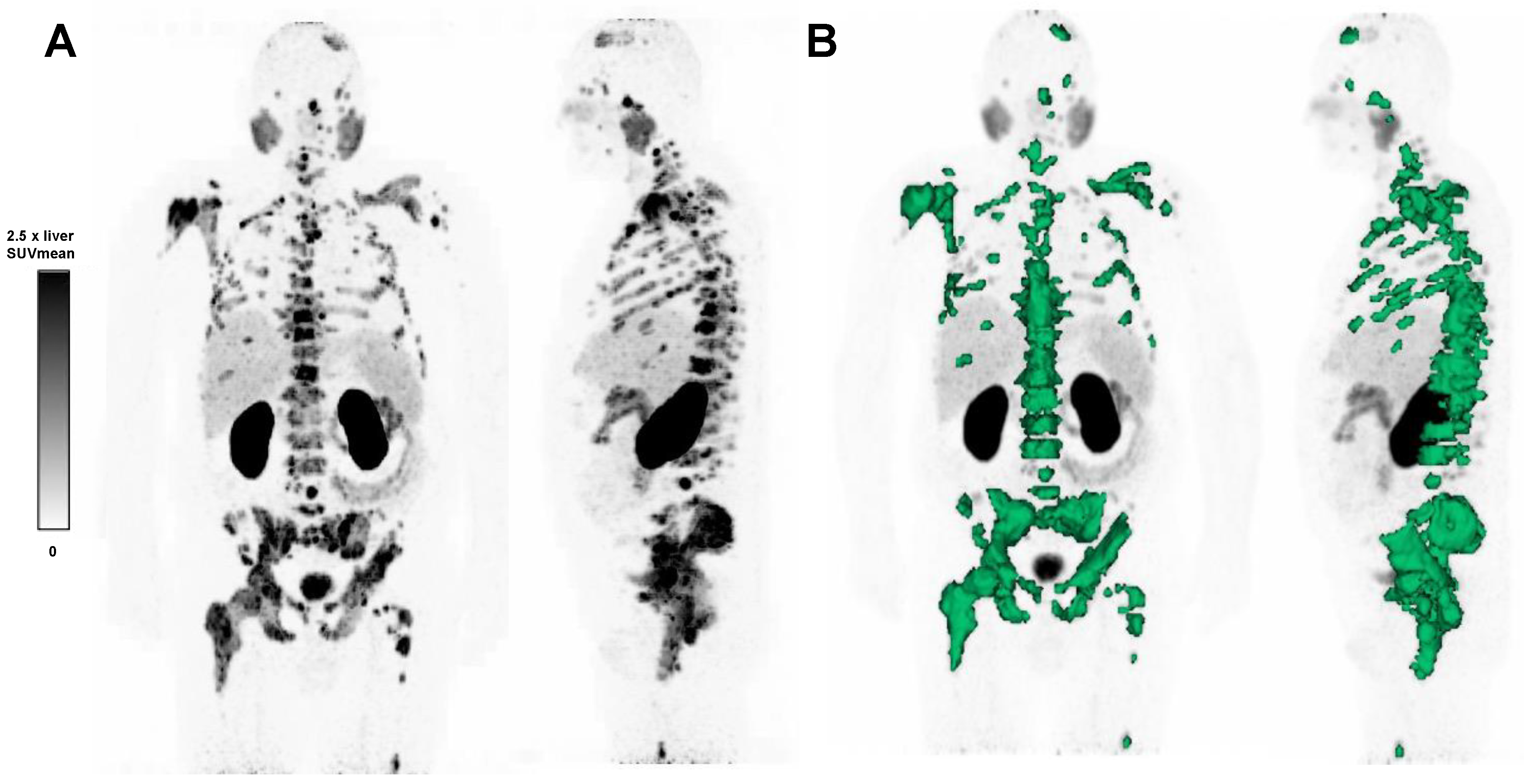 Cancers 15 02592 g001 Cancers 15 02592 g001
