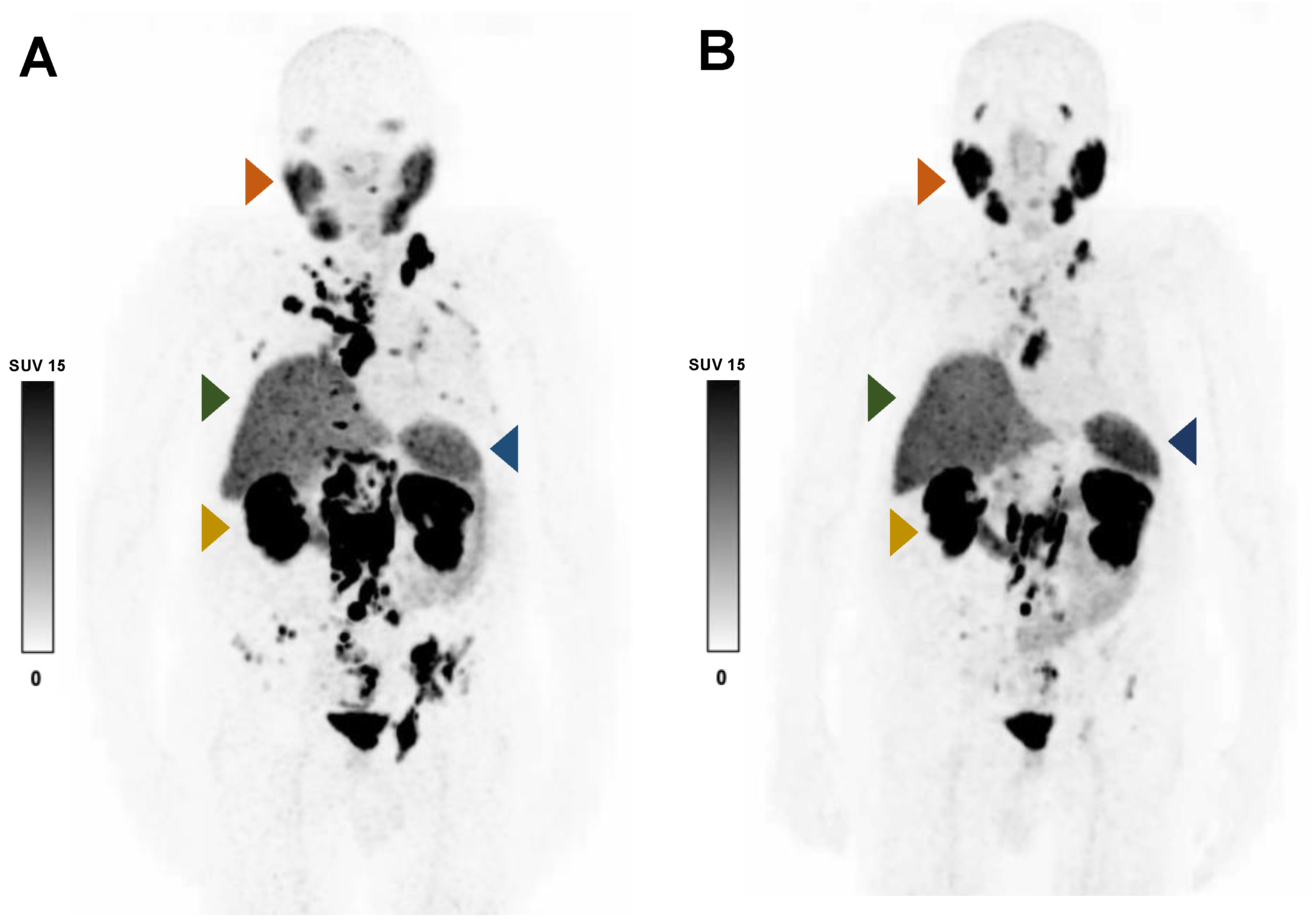 Cancers 15 02592 g004 Cancers 15 02592 g004