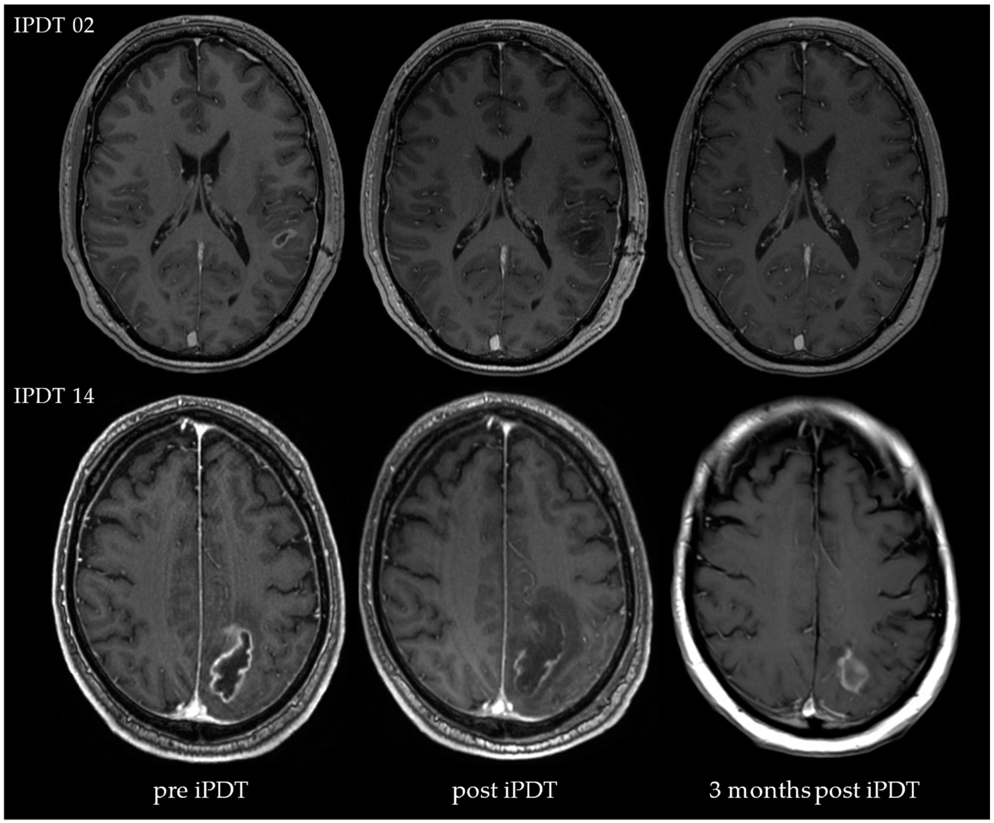 Cancers 15 02603 g003