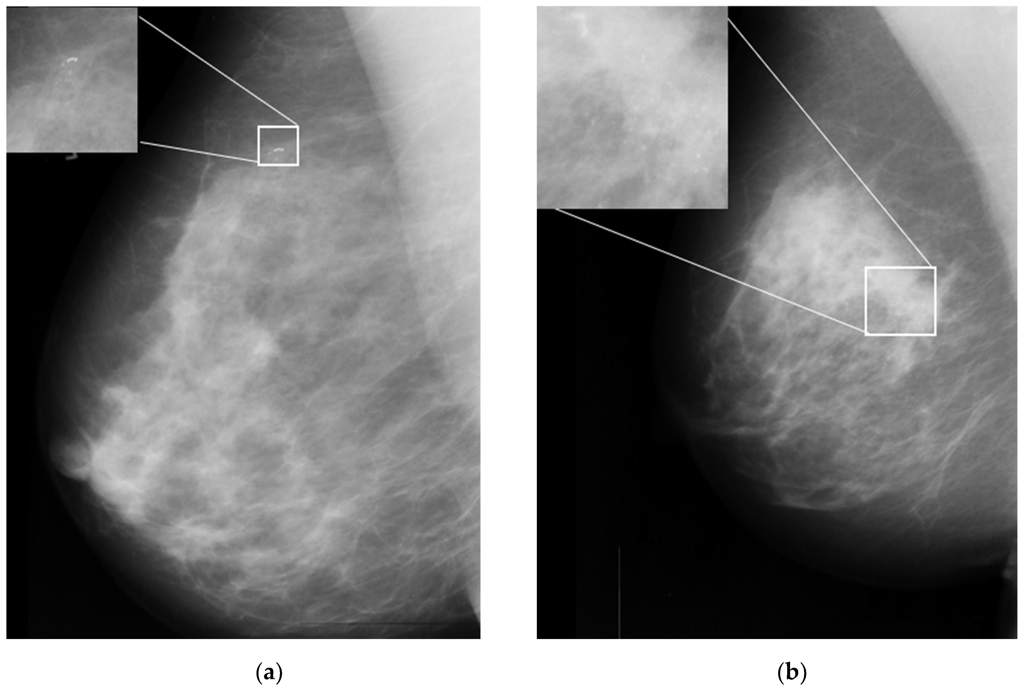 Cancers 15 02606 g001