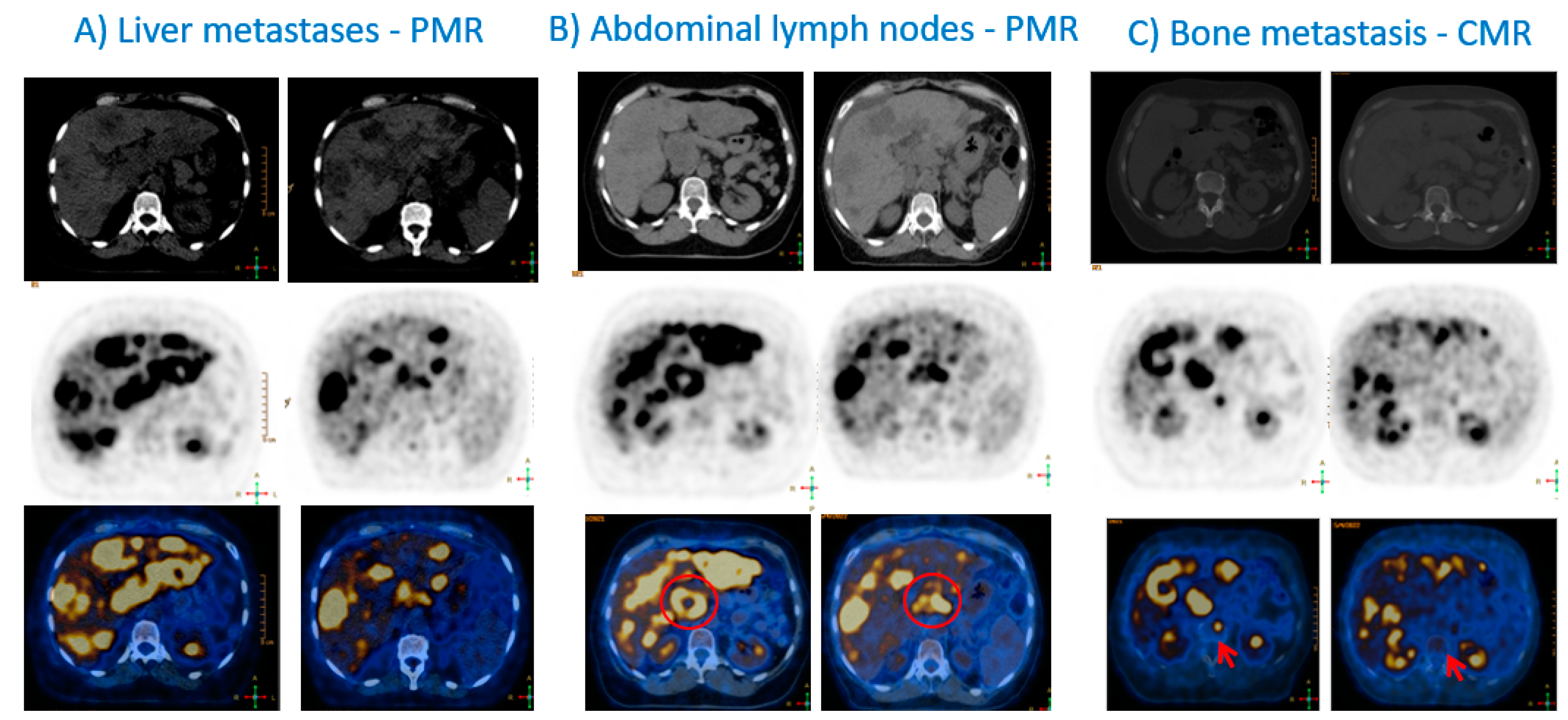 Cancers 15 02620 g002