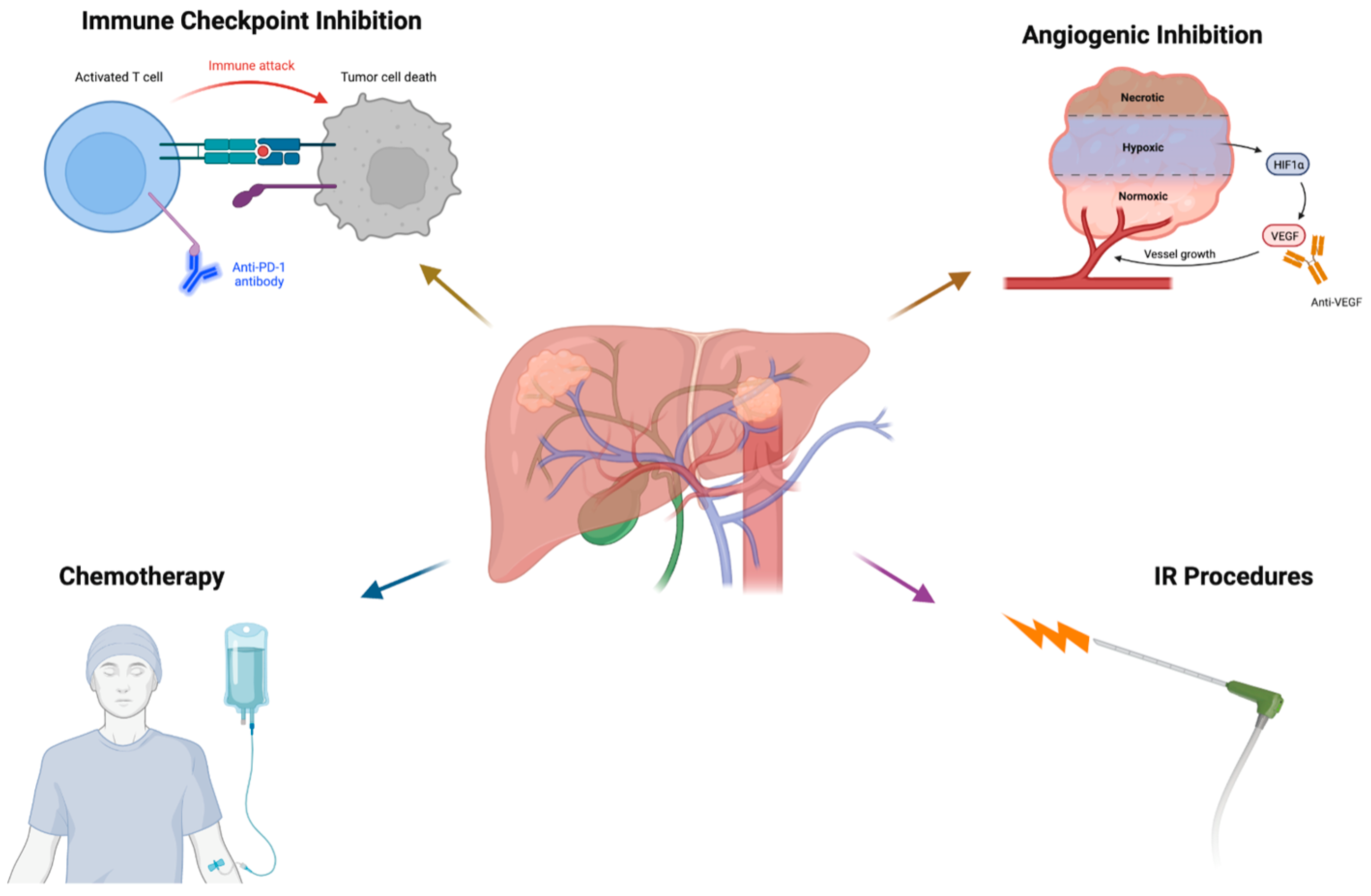 ls- model nude check mate z' Potential Immunotherapy Targets for Liver-Directed Therapies, and the  Current Scope of Immunotherapeutics for Liver-Related Malignancies
