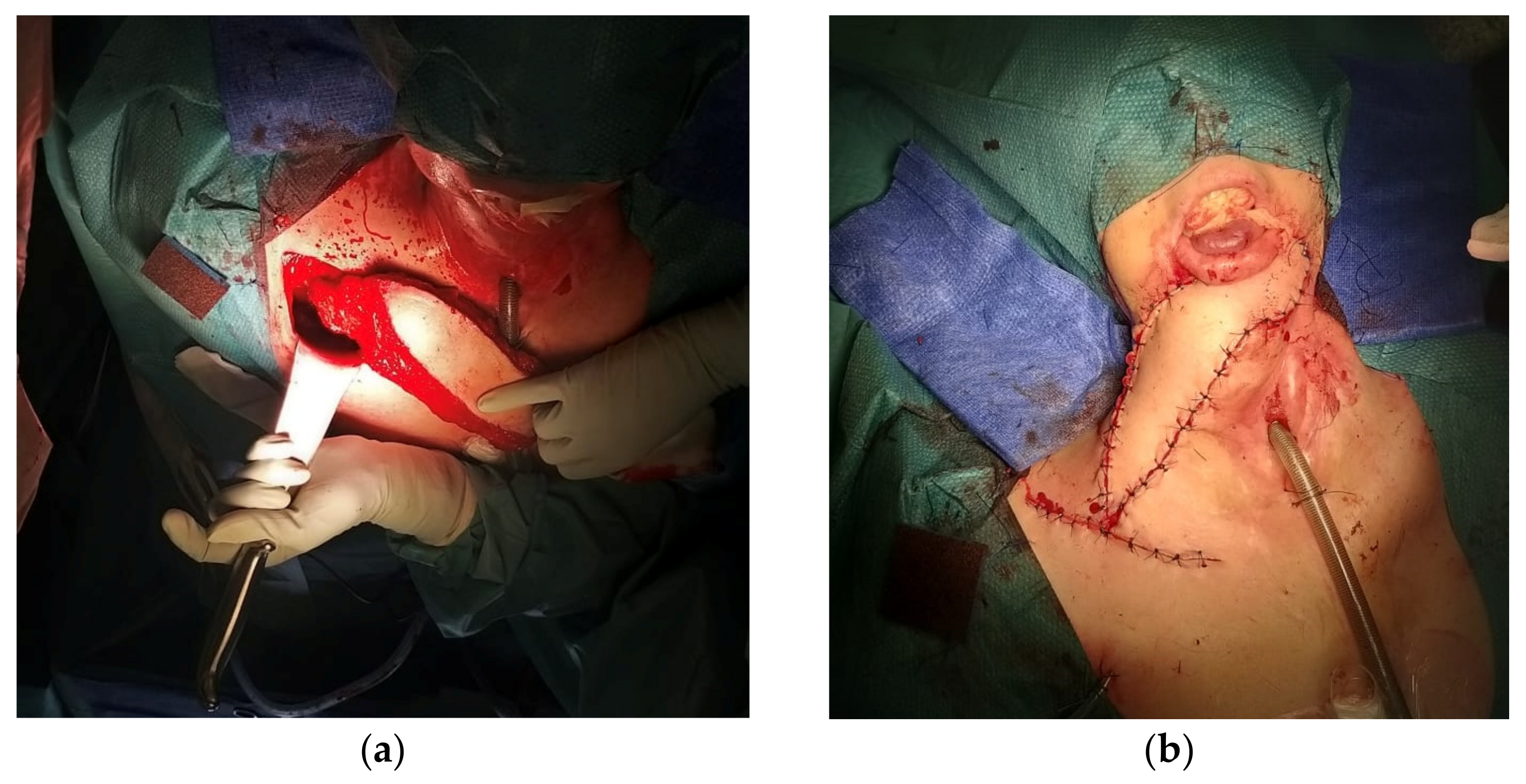 Cancers 15 02625 g002 Cancers 15 02625 g002