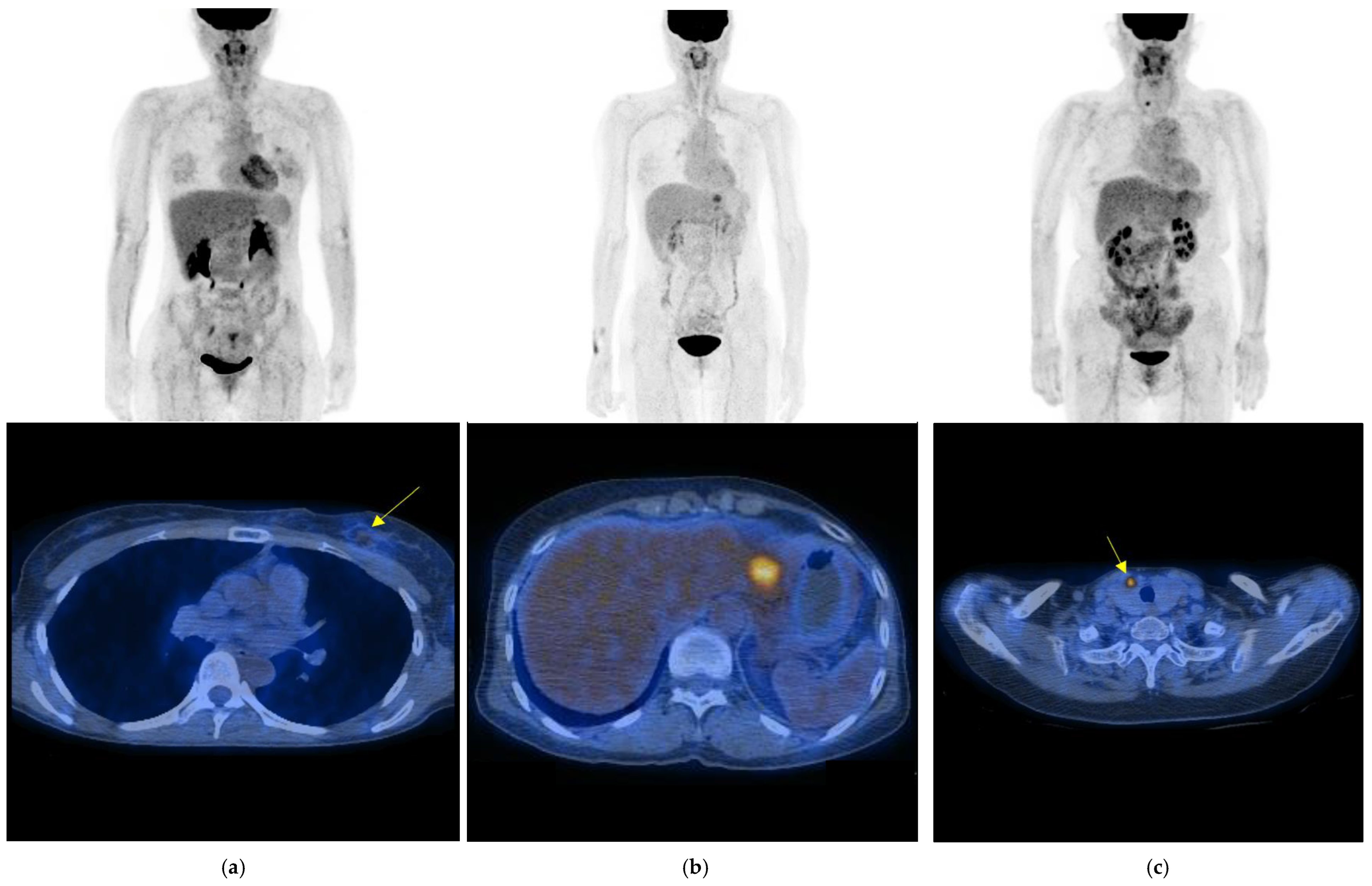 Cancers 15 02646 g002 Cancers 15 02646 g002