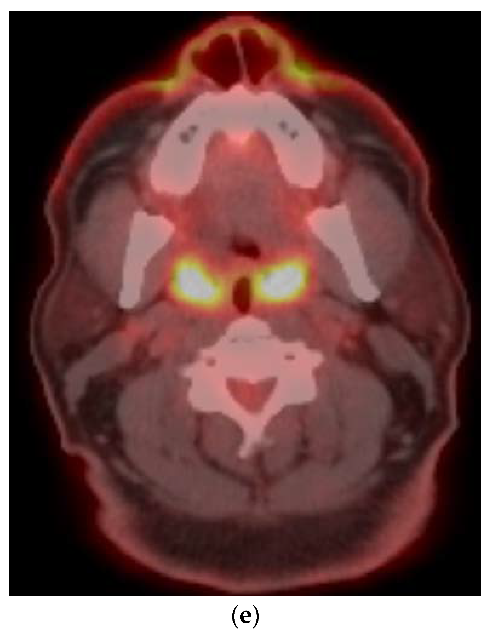 Cancers 15 02651 g001b