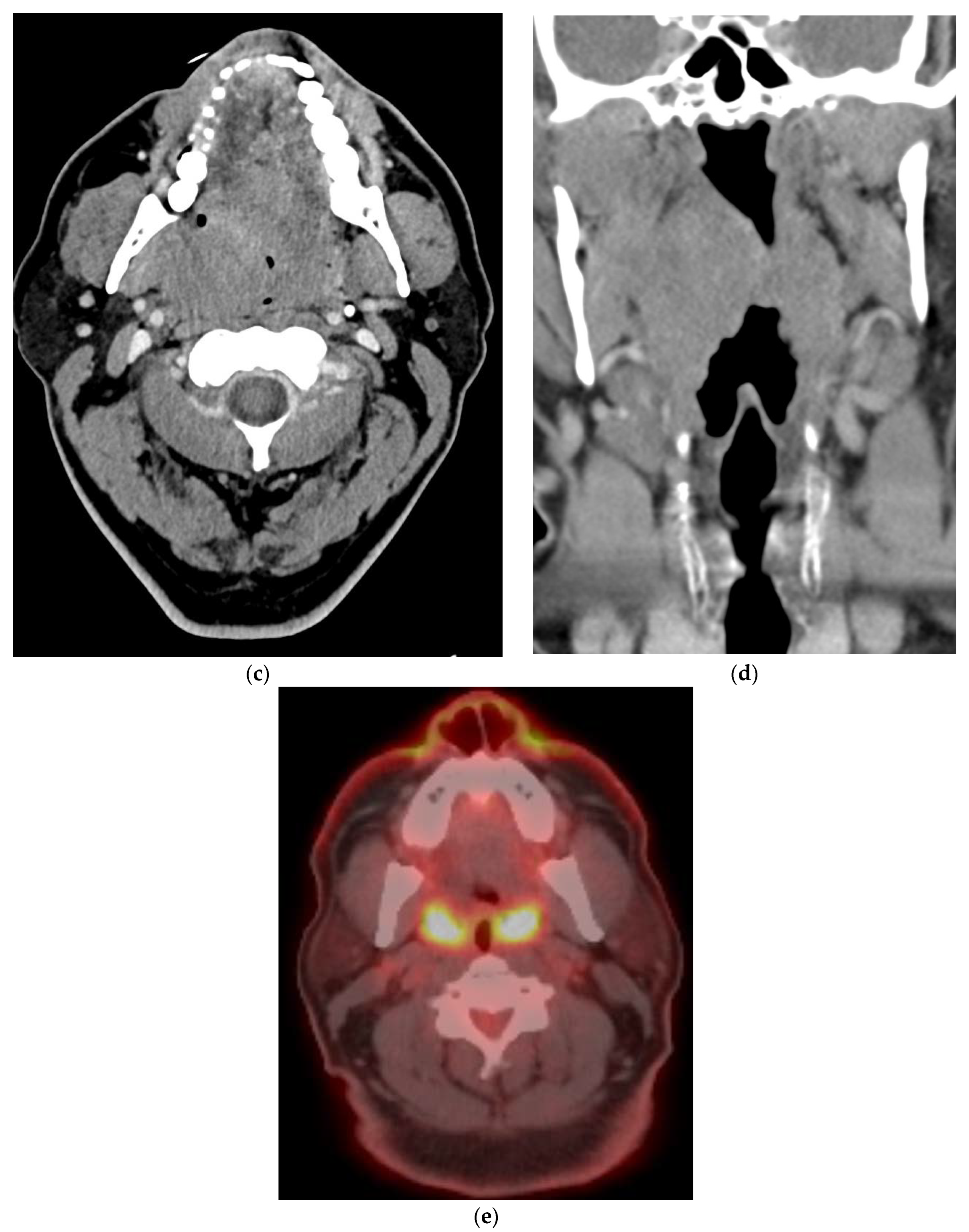 Cancers 15 02651 g002b