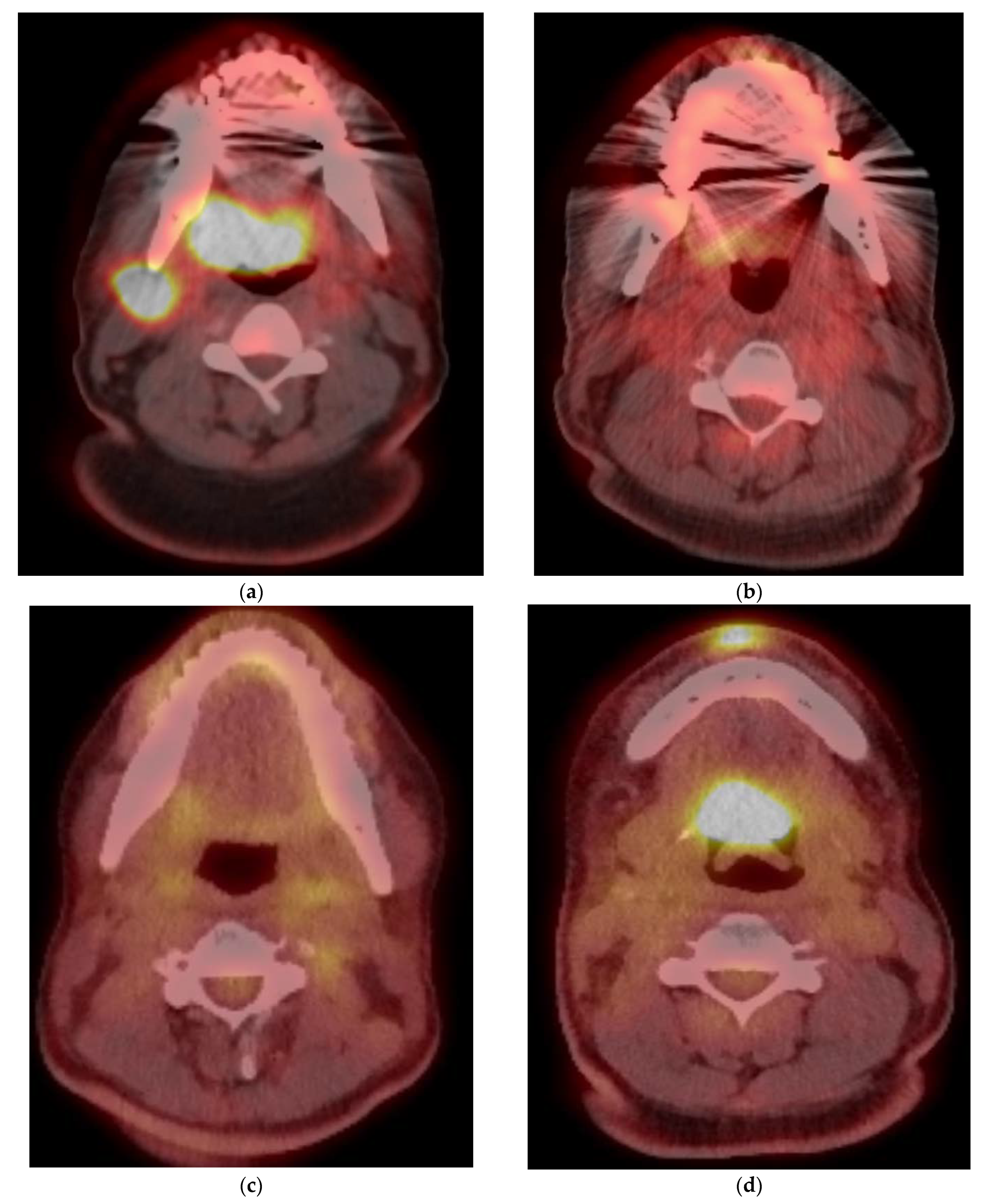 Cancers 15 02651 g003a