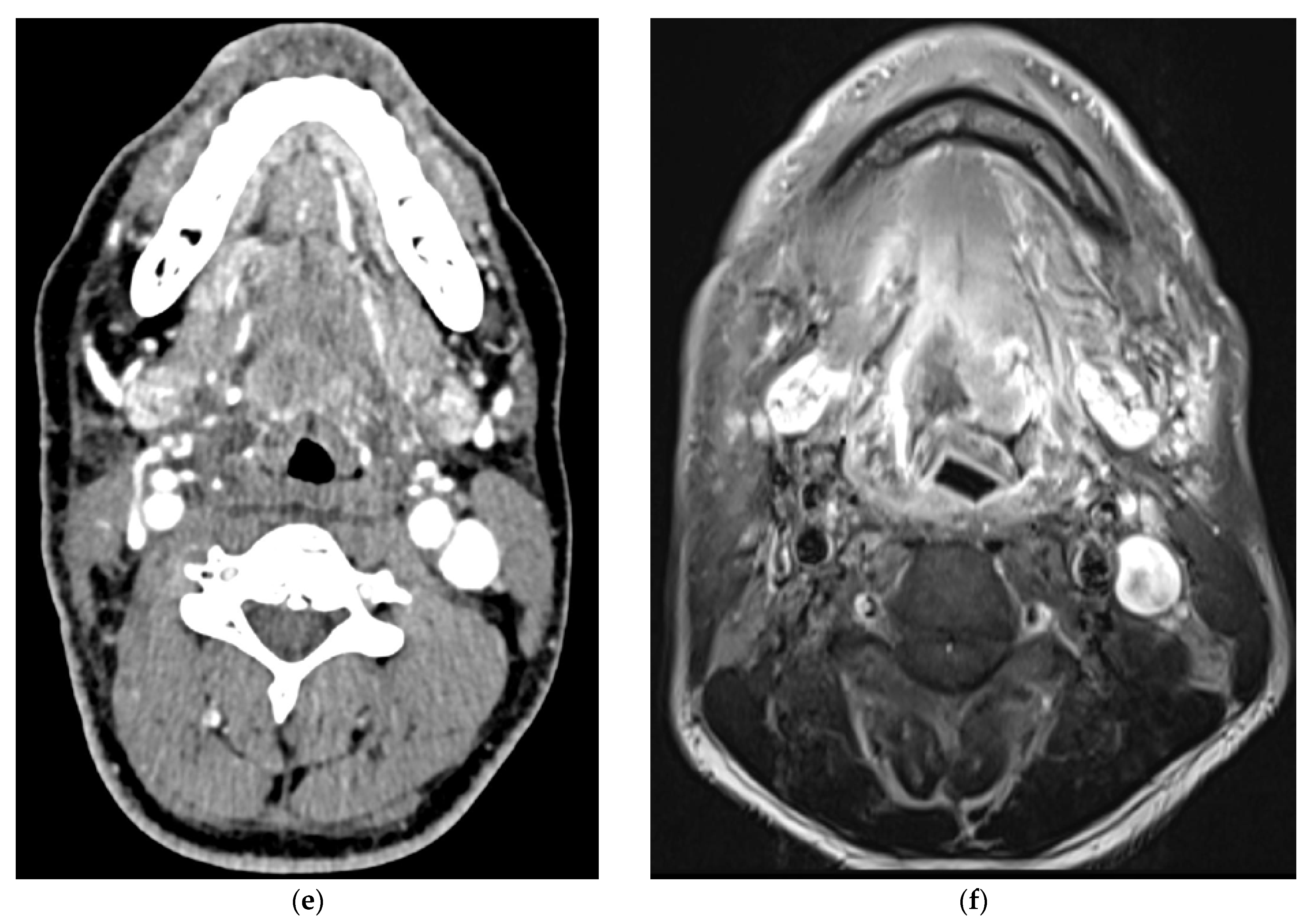 Cancers 15 02651 g003b