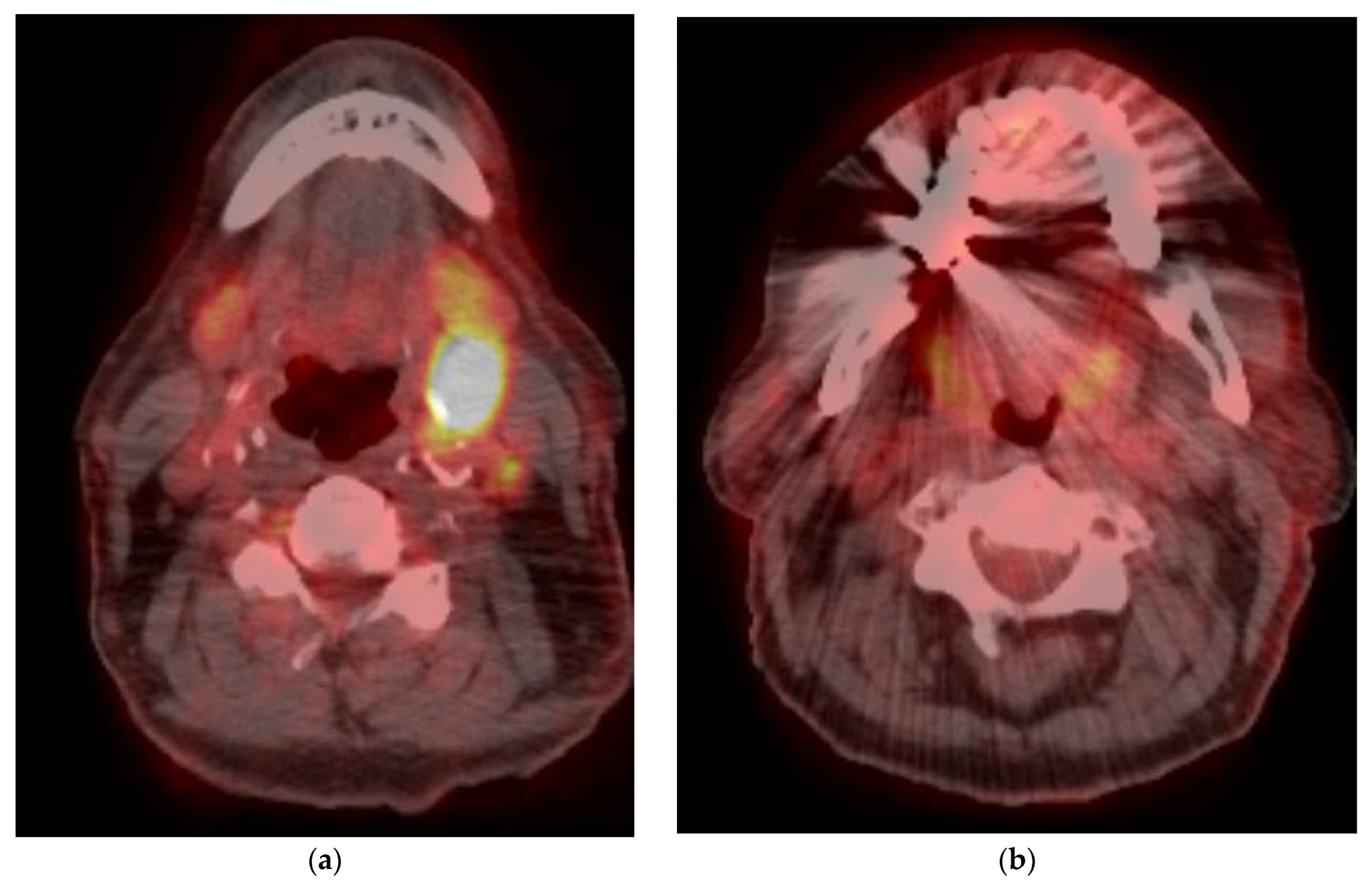 Cancers 15 02651 g004a