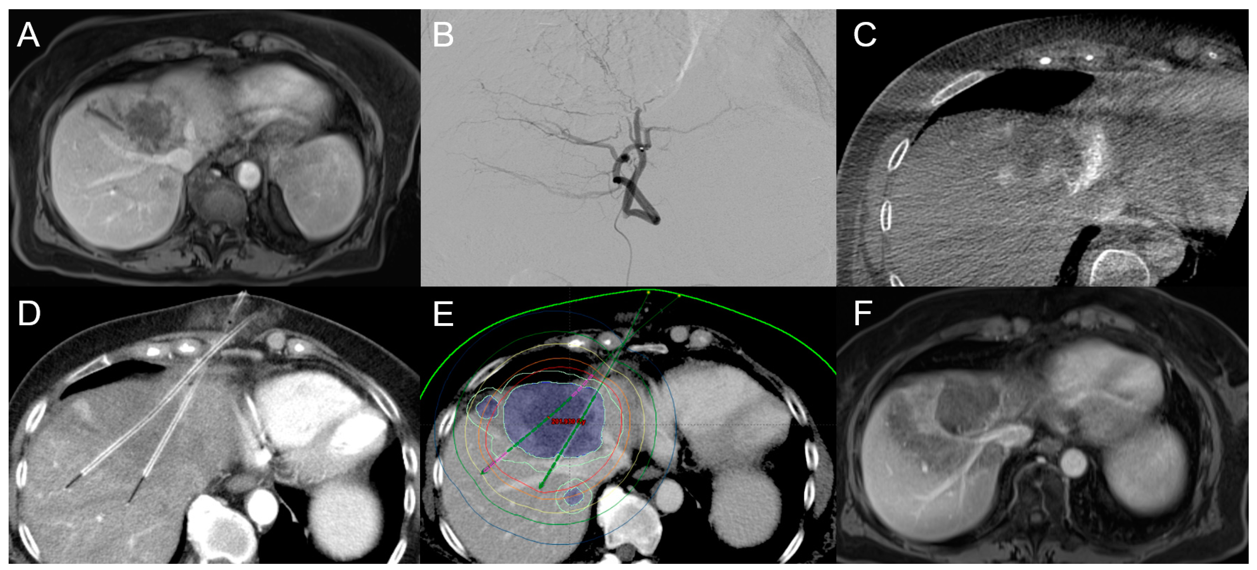 Cancers 15 02655 g005 Cancers 15 02655 g005