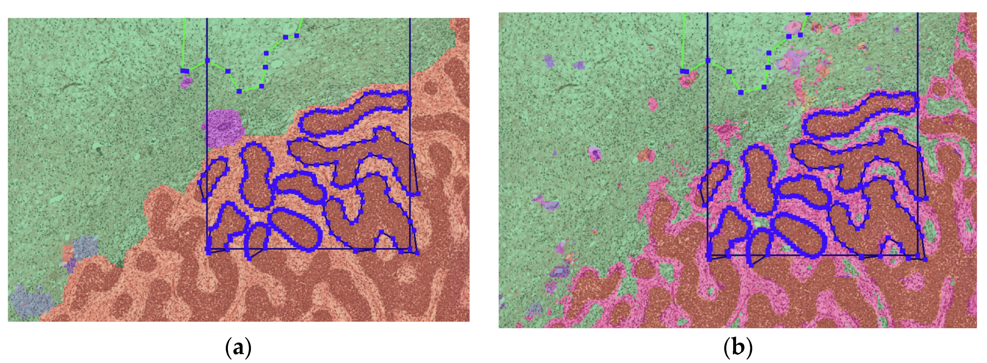 Cancers 15 02656 g002 Cancers 15 02656 g002