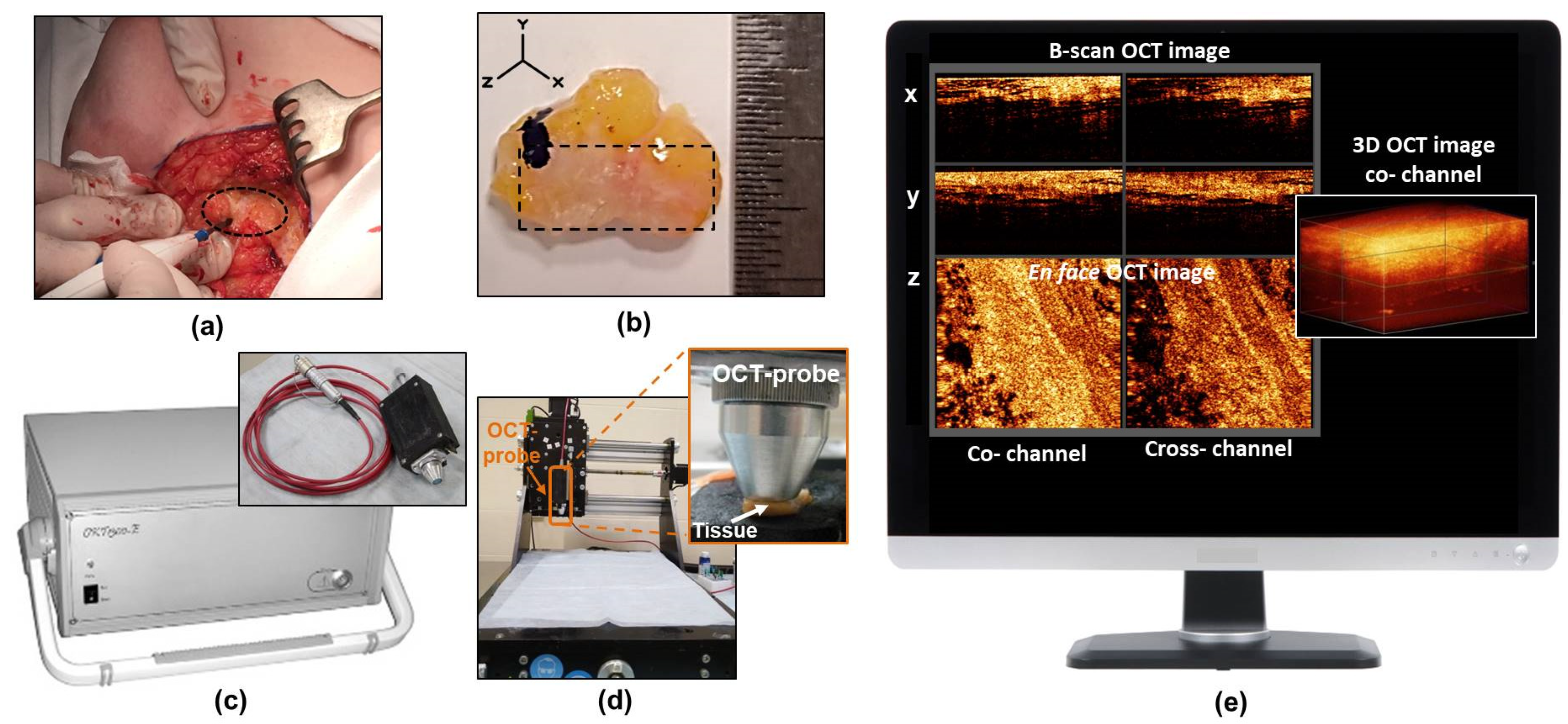 Cancers 15 02663 g001 Cancers 15 02663 g001
