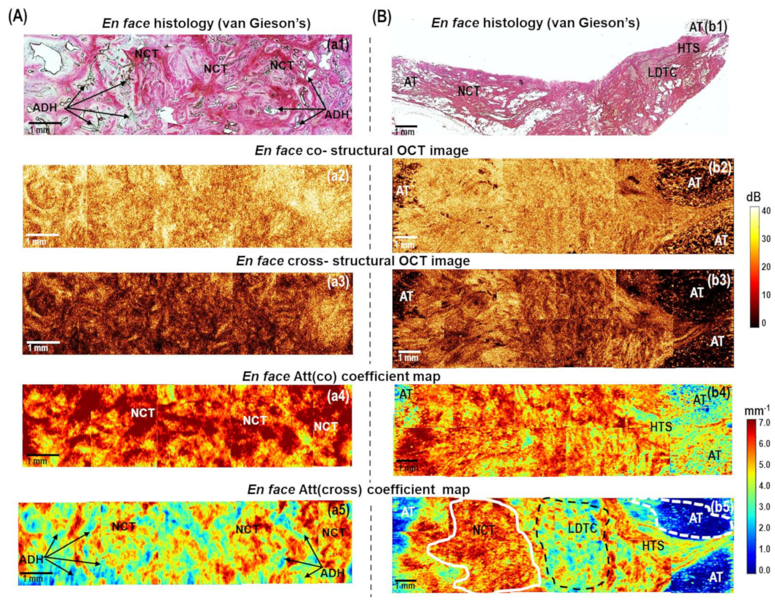 Cancers 15 02663 g003 Cancers 15 02663 g003