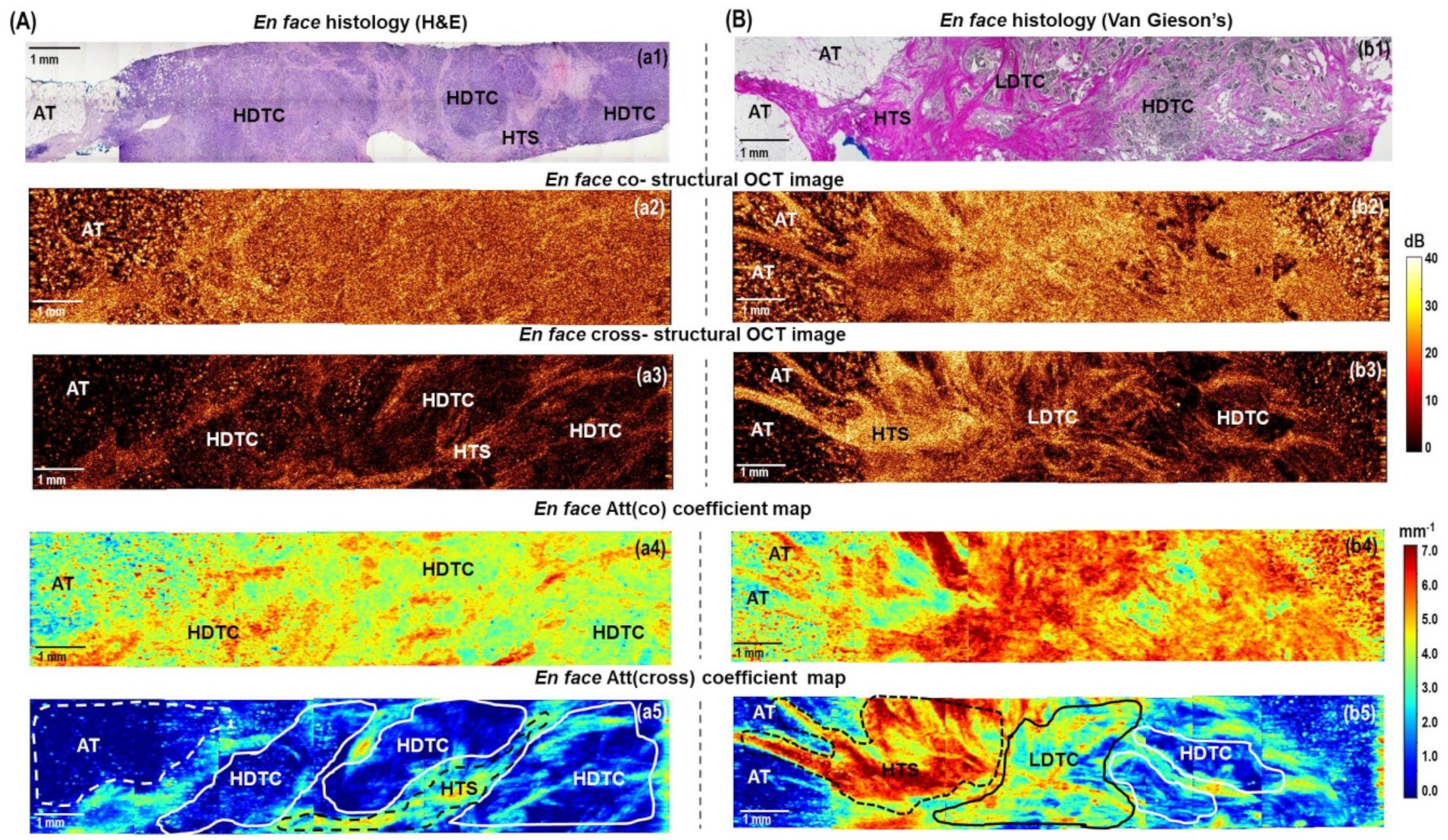 Cancers 15 02663 g005 Cancers 15 02663 g005