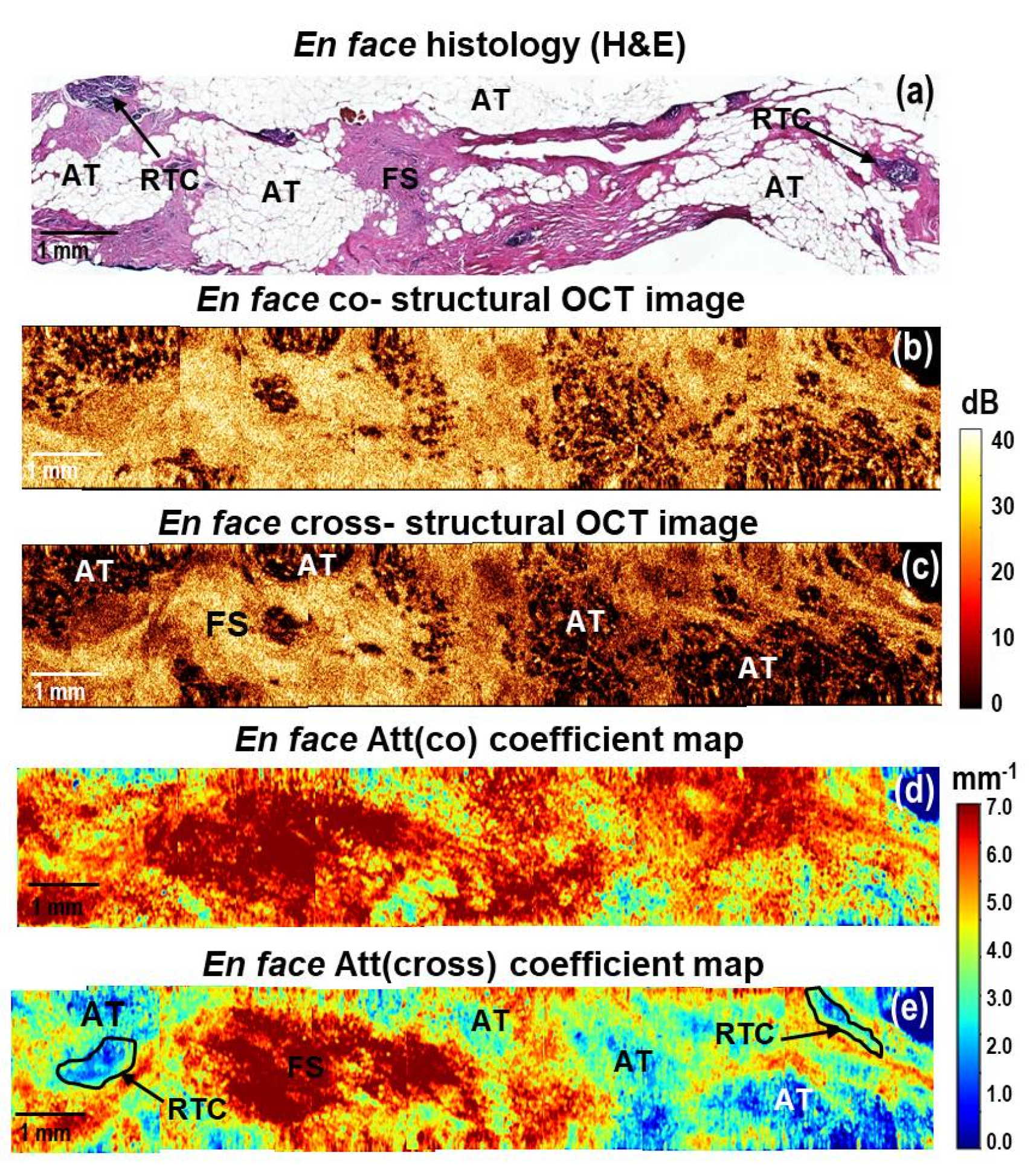 Cancers 15 02663 g006 Cancers 15 02663 g006