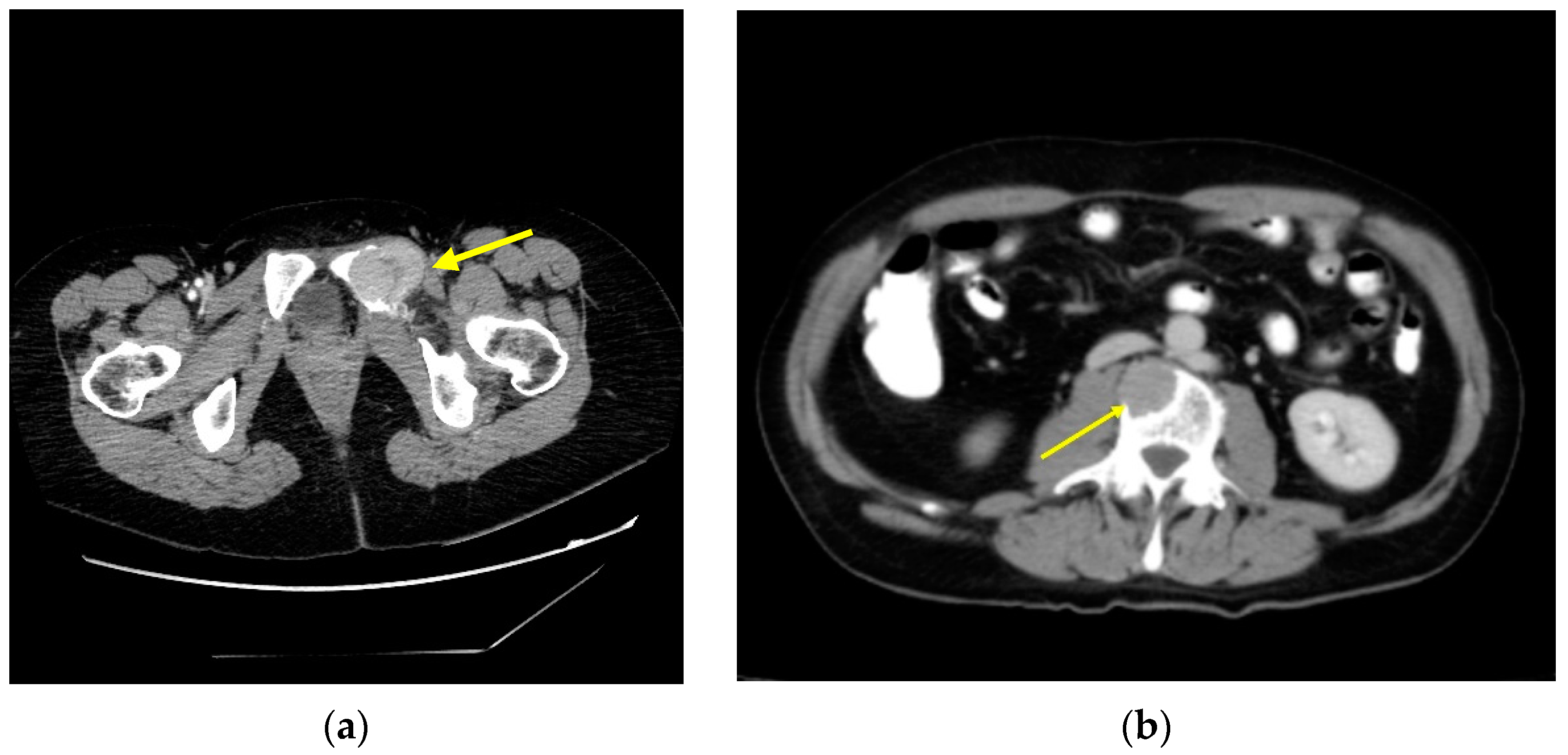 Cancers 15 02692 g002 Cancers 15 02692 g002