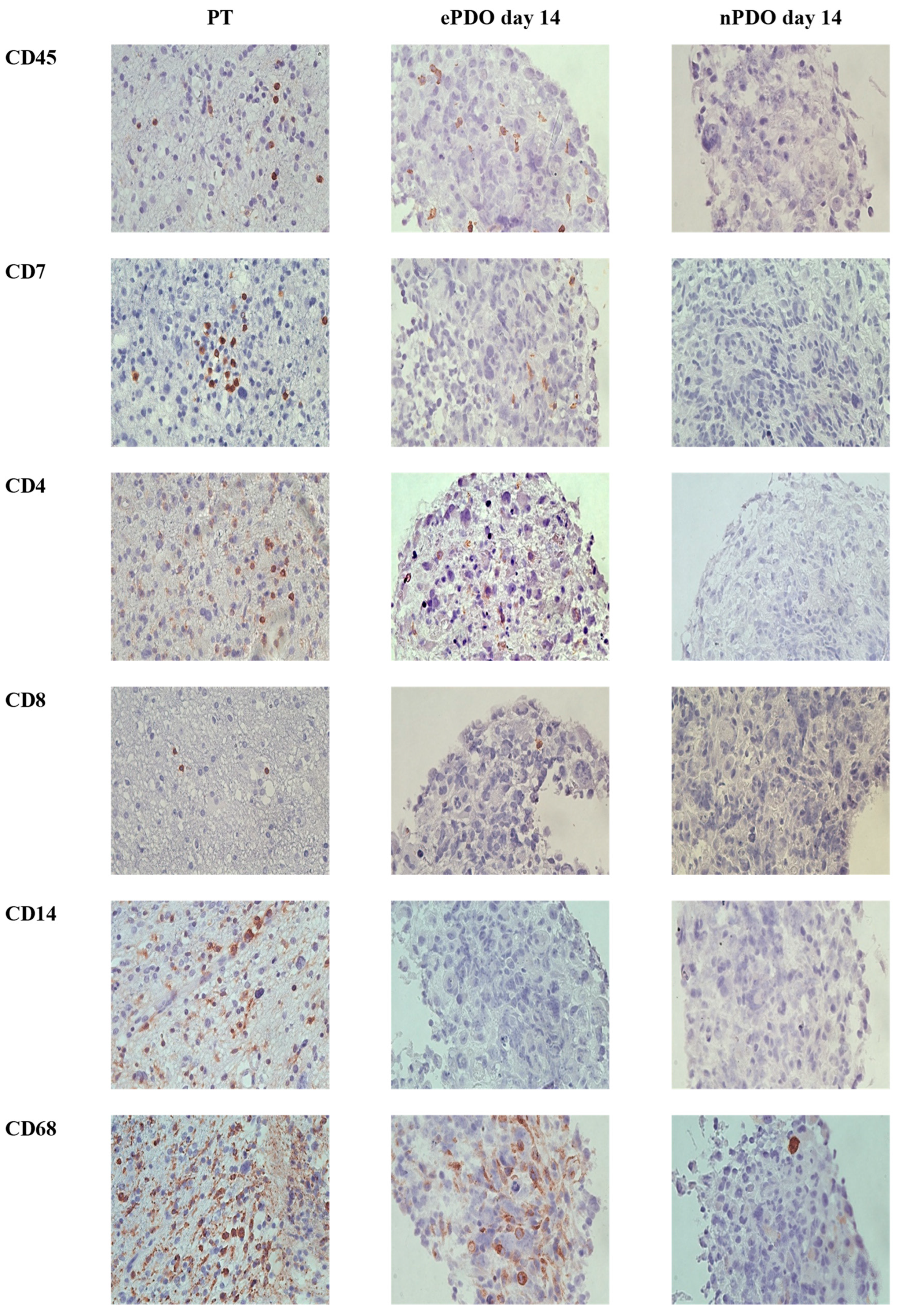 Cancers 15 02698 g007a Cancers 15 02698 g007a