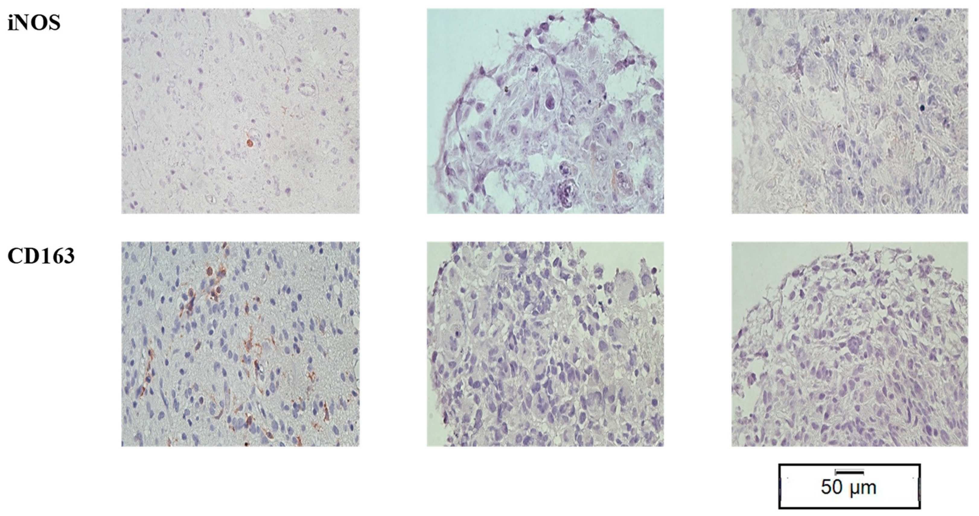 Cancers 15 02698 g007b Cancers 15 02698 g007b