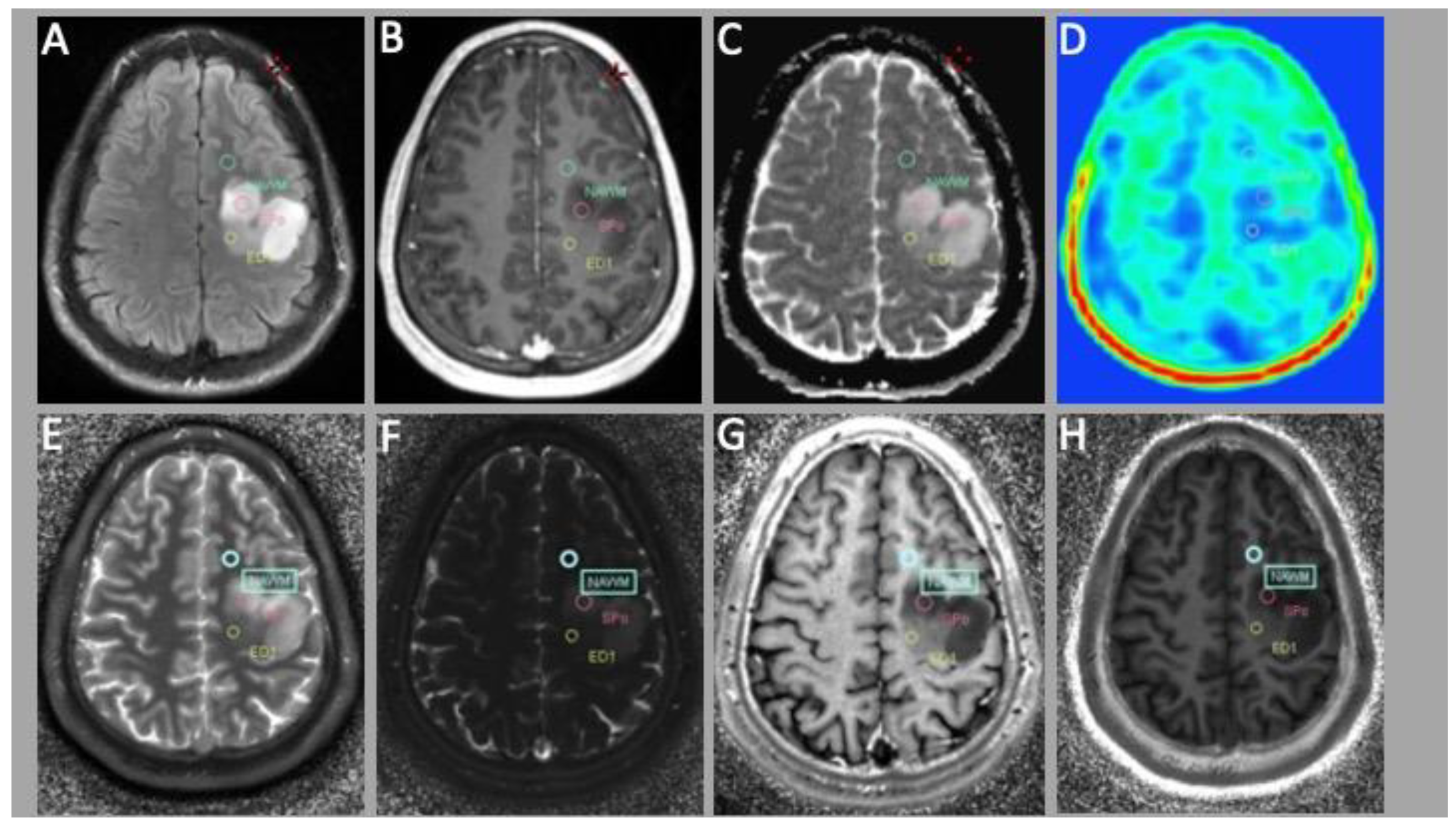 Cancers 15 02740 g001 Cancers 15 02740 g001