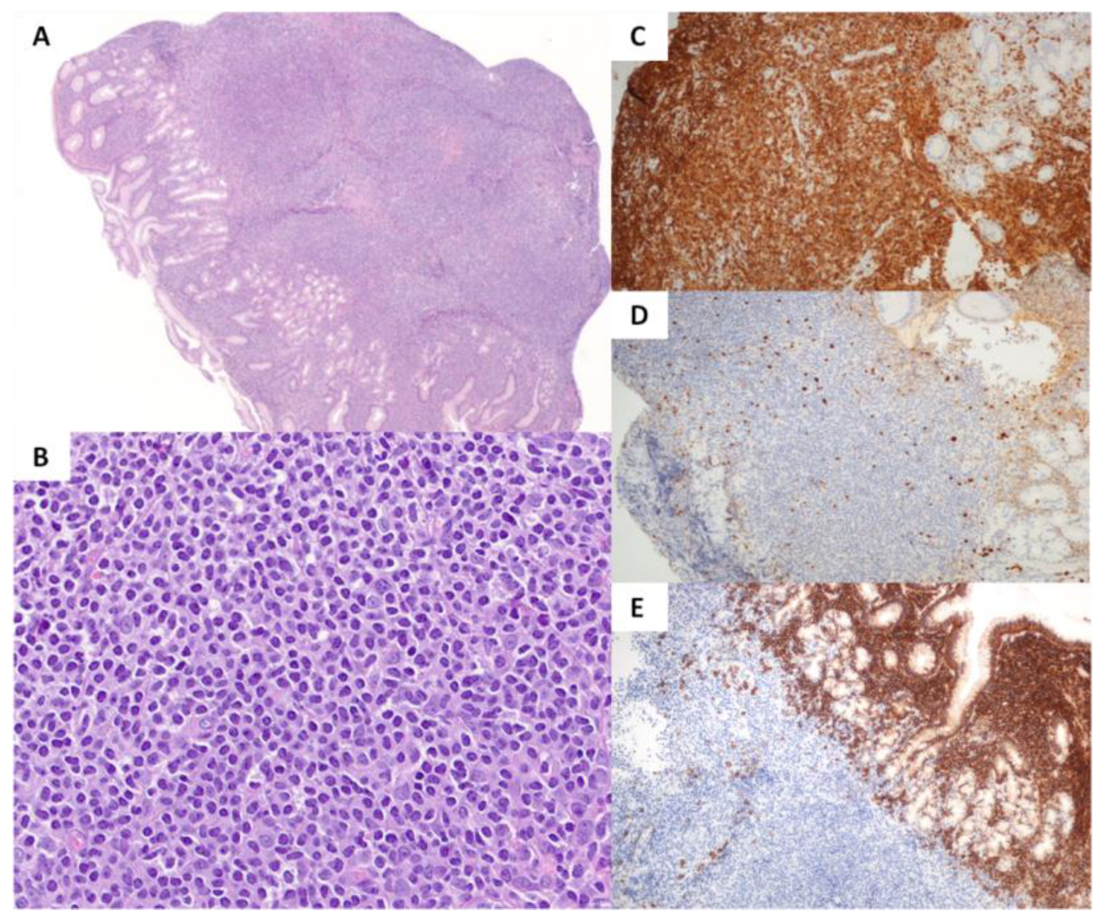 Cancers 15 02743 g004