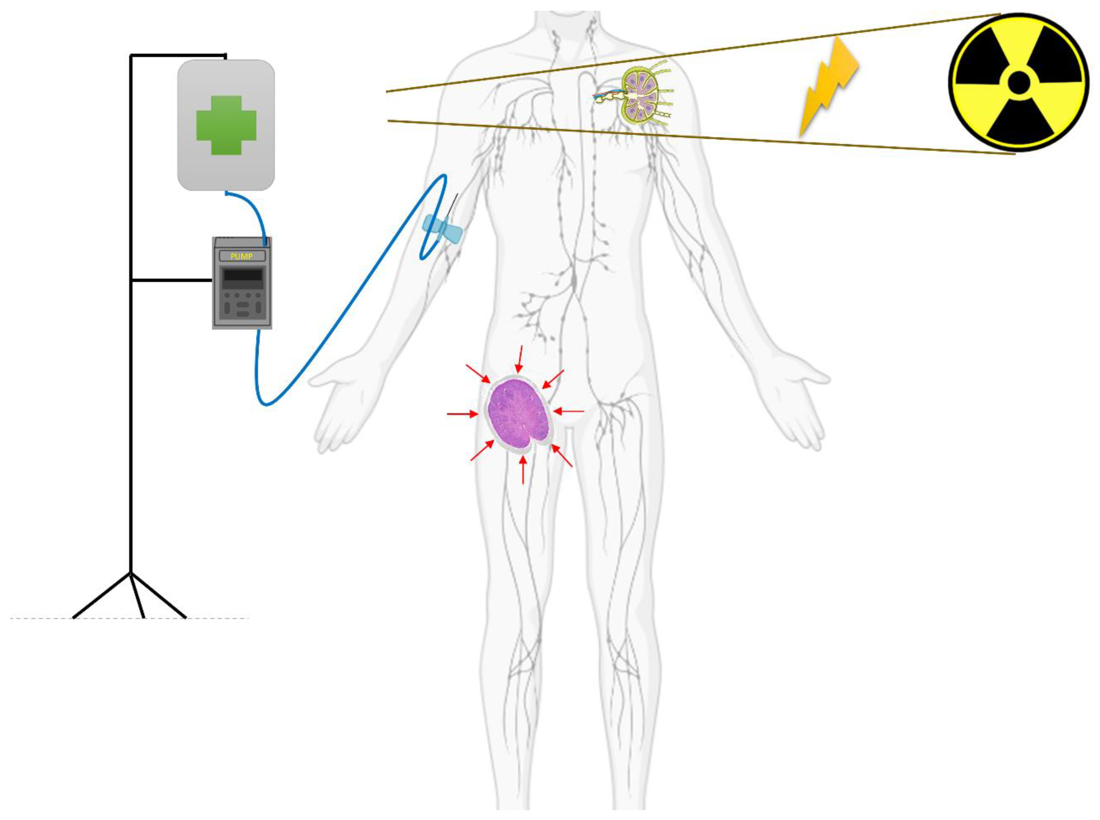 Cancers 15 02751 g002 Cancers 15 02751 g002