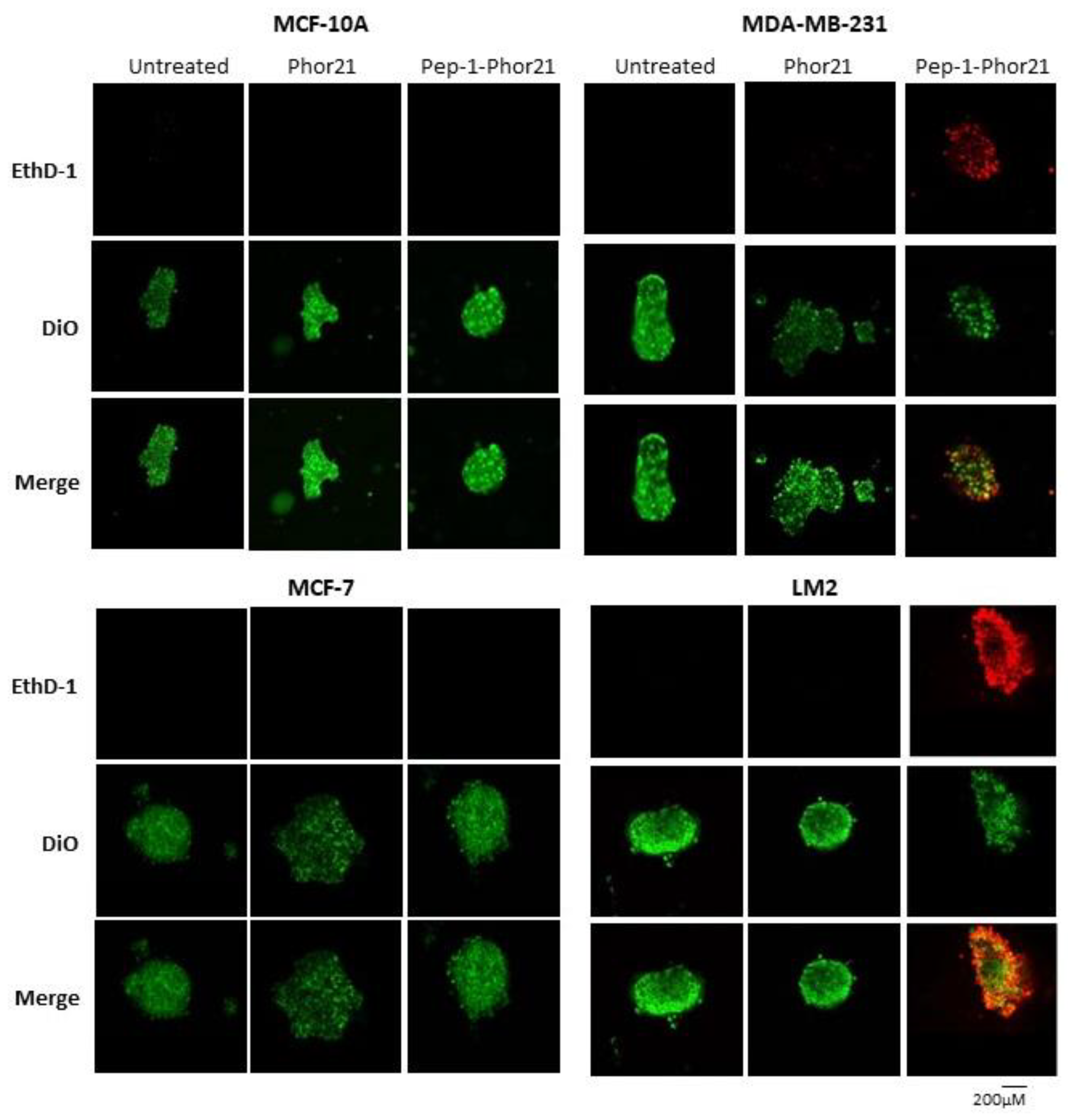 Cancers 15 02772 g009 Cancers 15 02772 g009