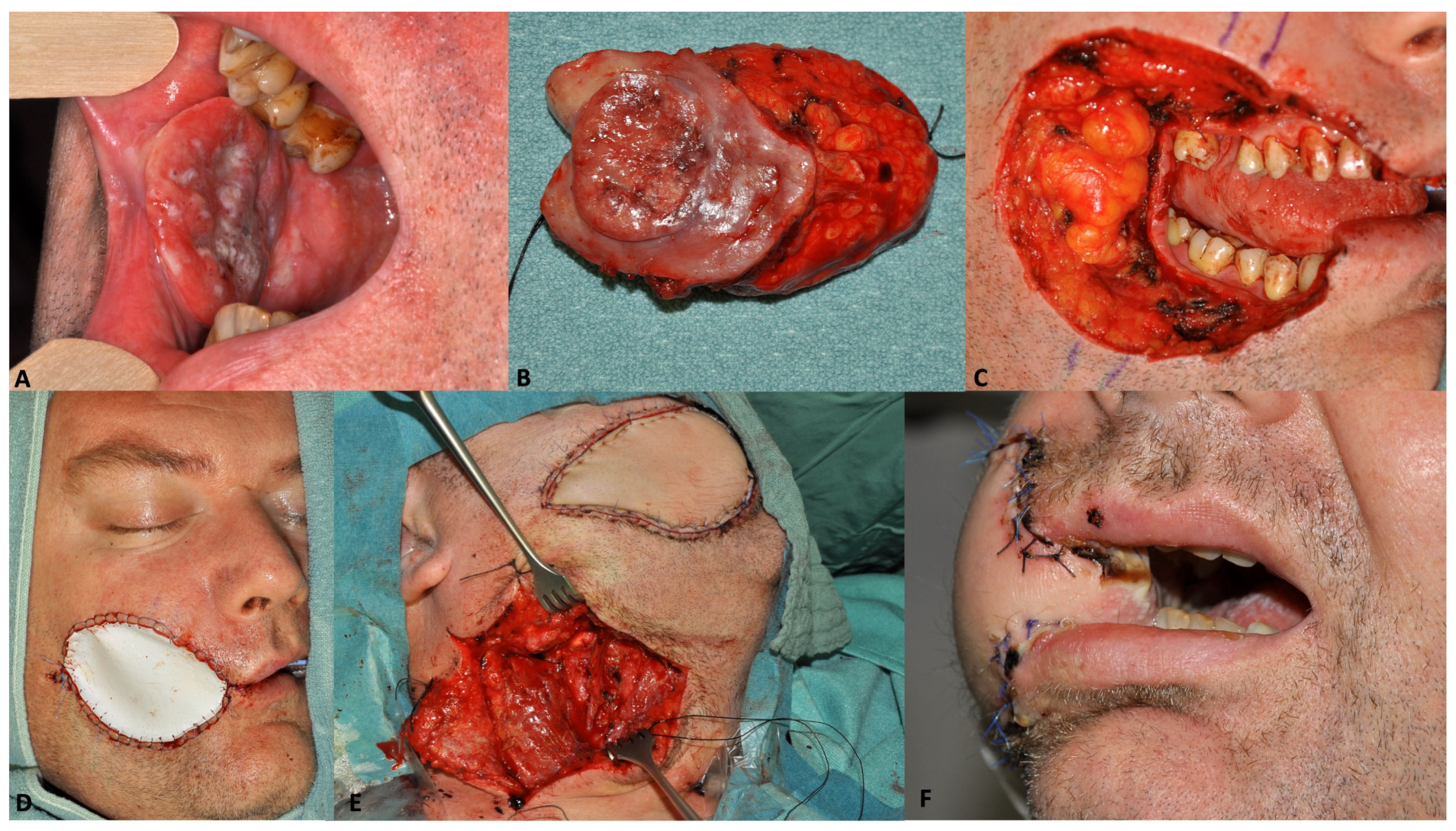 Cancers 15 02777 g001