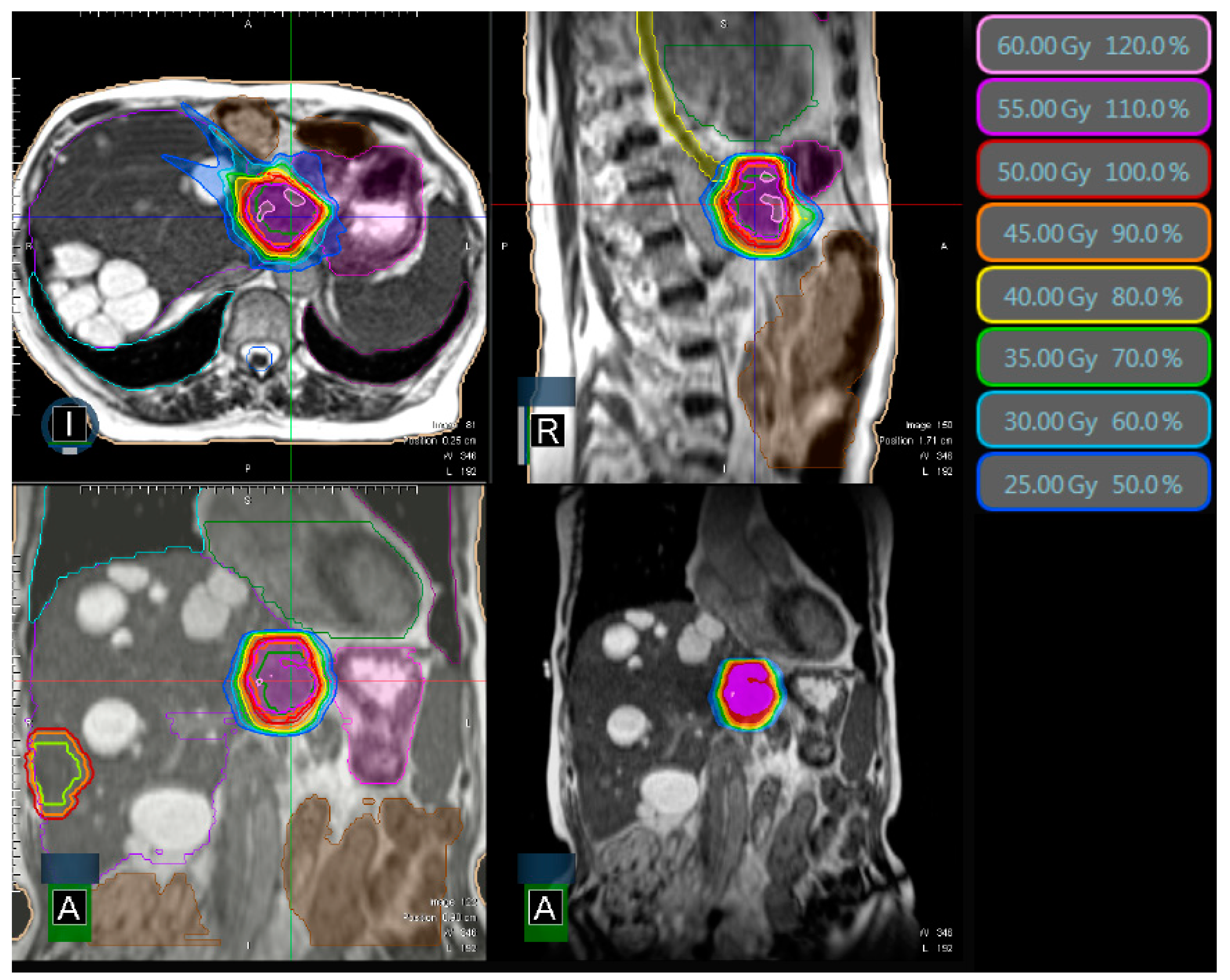 Cancers 15 02786 g001