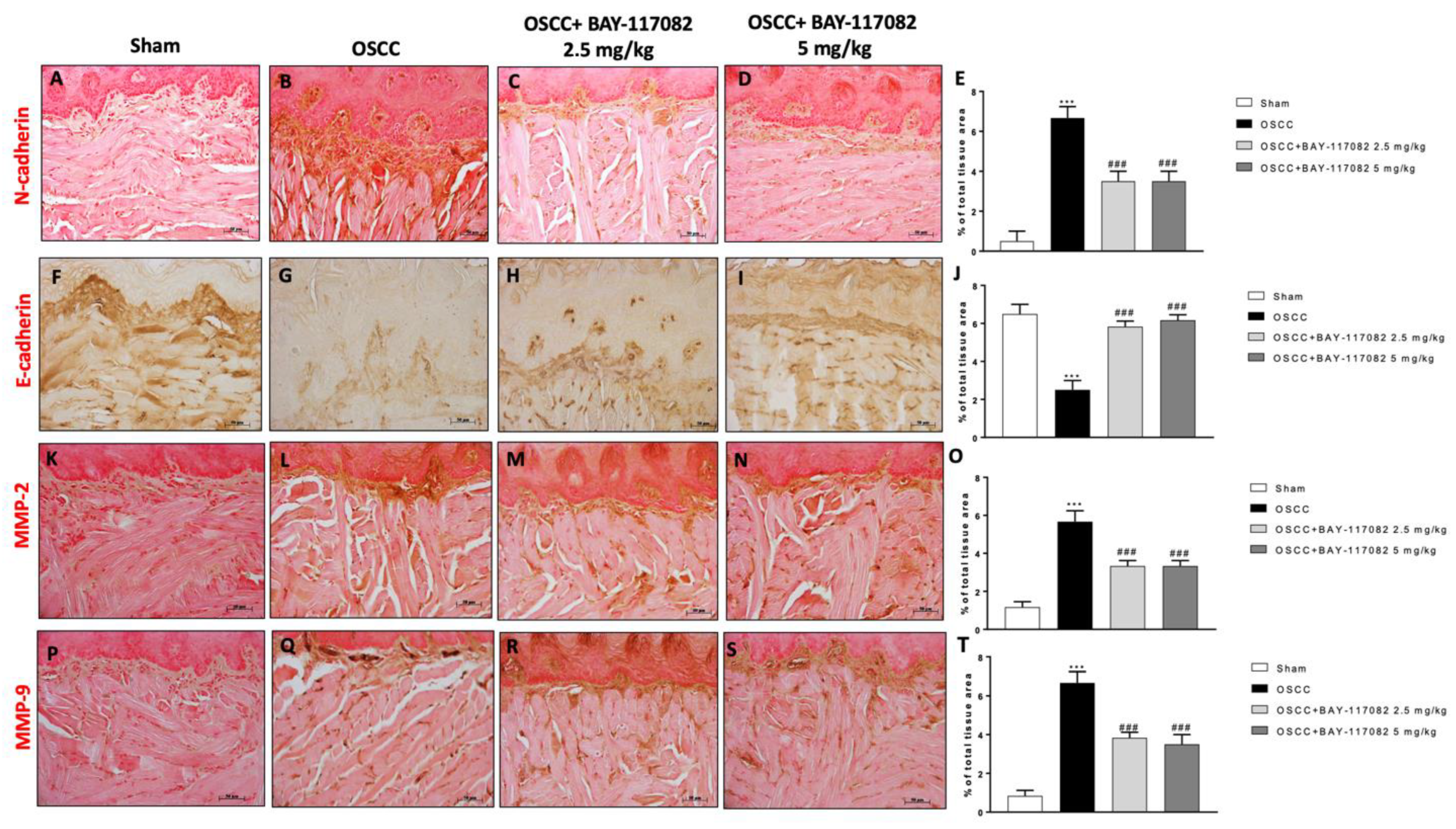 Cancers 15 02796 g003 Cancers 15 02796 g003