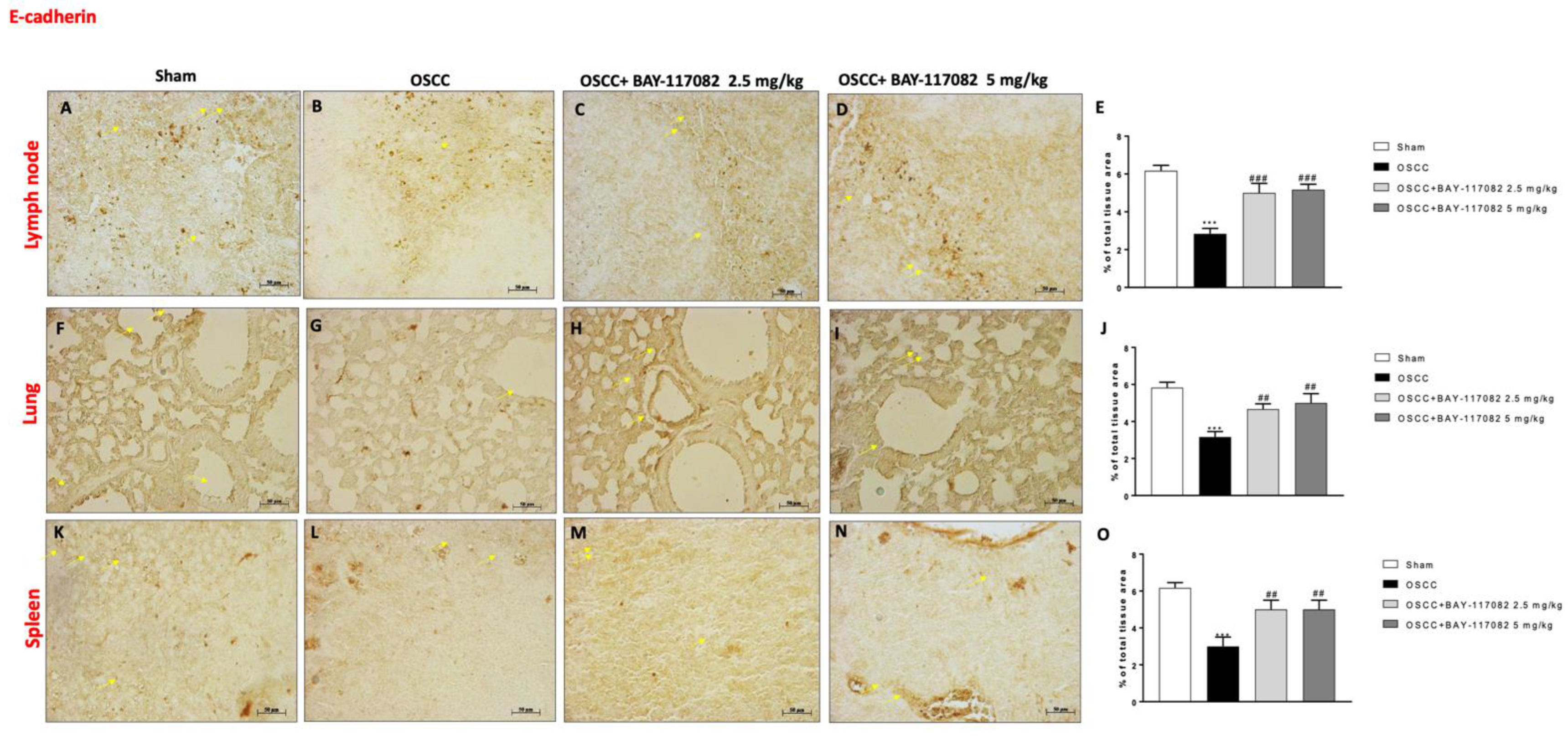 Cancers 15 02796 g006 Cancers 15 02796 g006