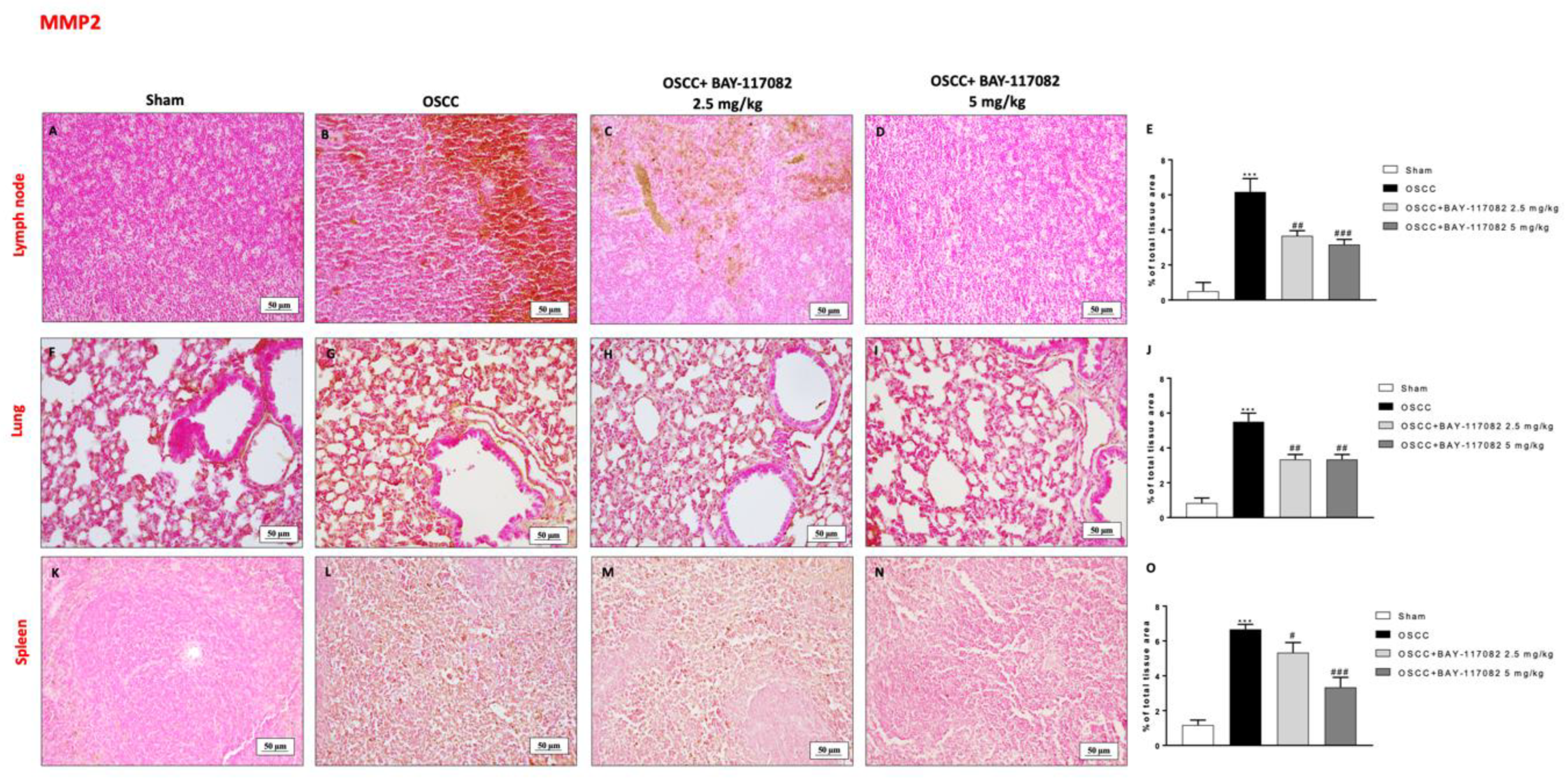 Cancers 15 02796 g008 Cancers 15 02796 g008