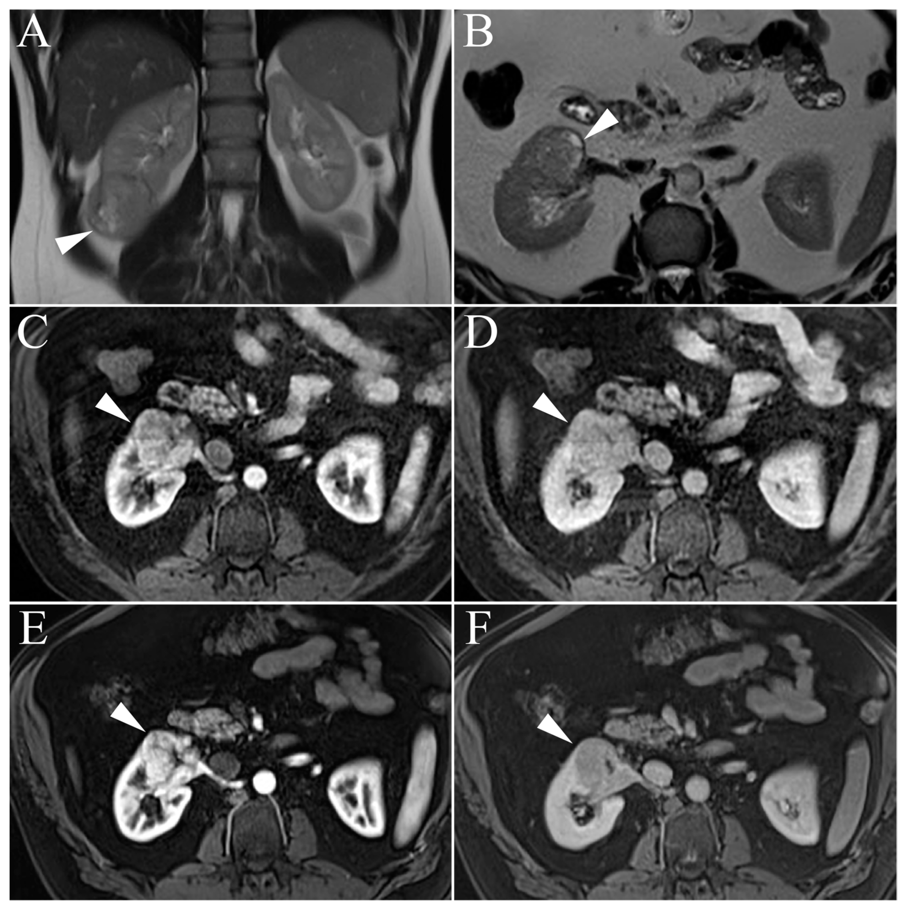 Cancers 15 02799 g003