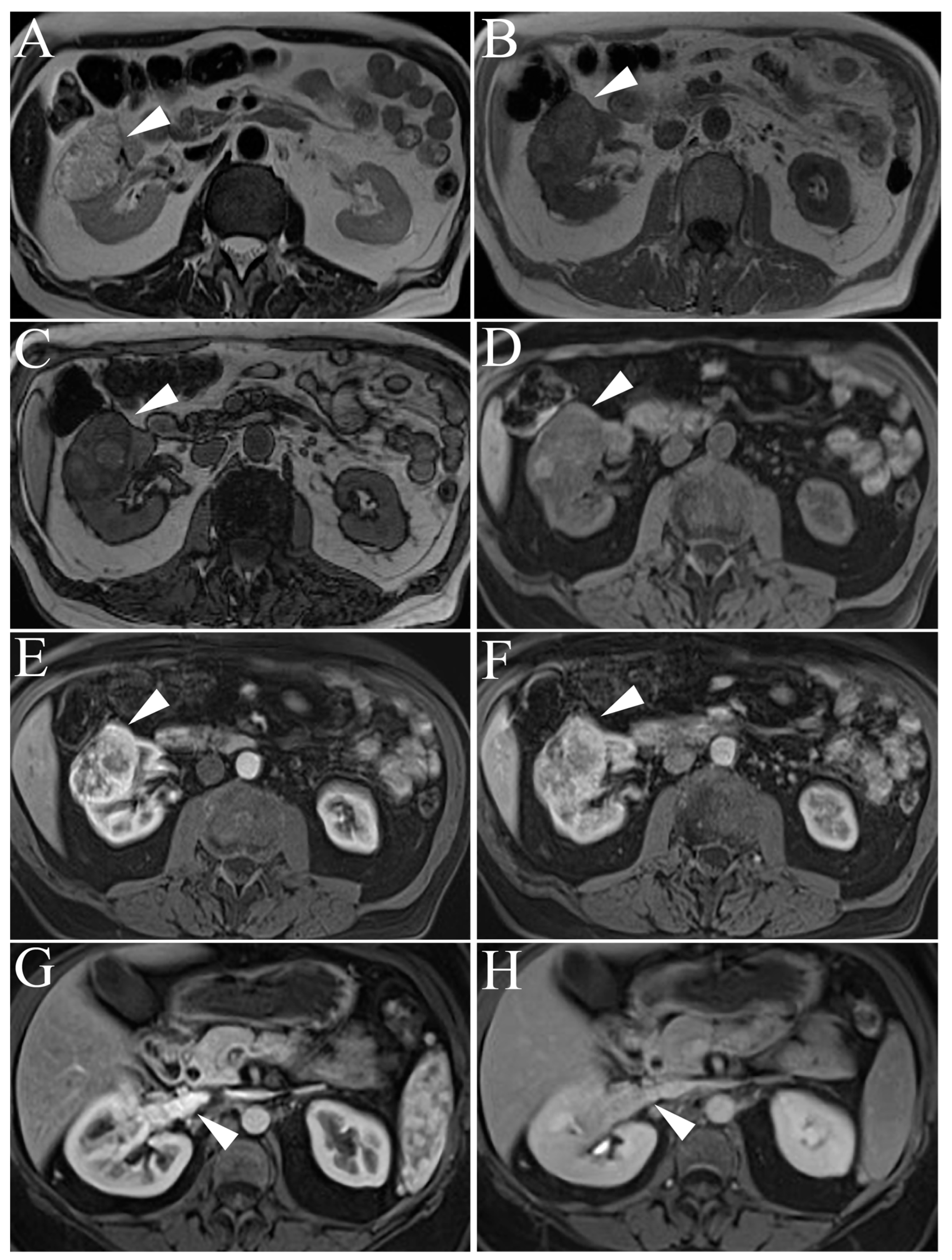 Cancers 15 02799 g004