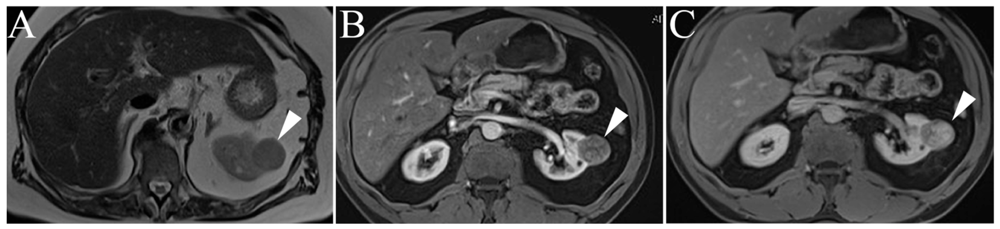 Cancers 15 02799 g005